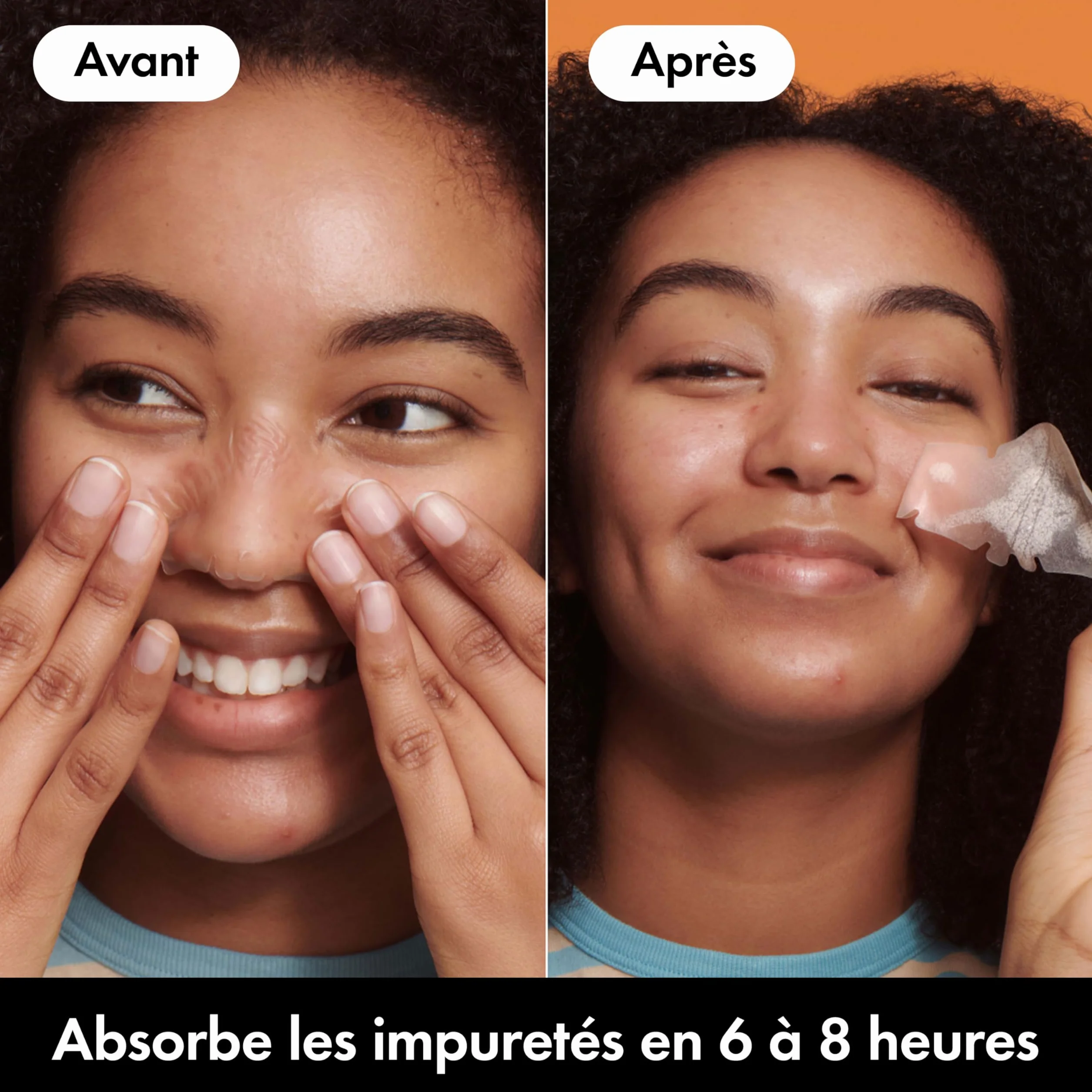 Hero Mighty Patch Nose: Patch anti-acné Hydrocolloïde 10 pièces
