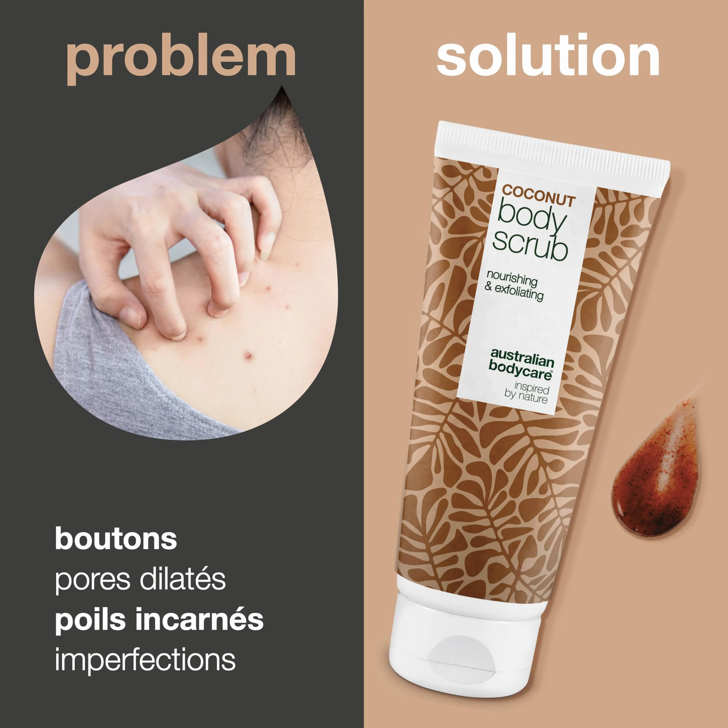 Australian Bodycare Gommage Corporelle Coco Body Scrub Exfoliant pour Impuretés, Boutons, Dos et Pieds