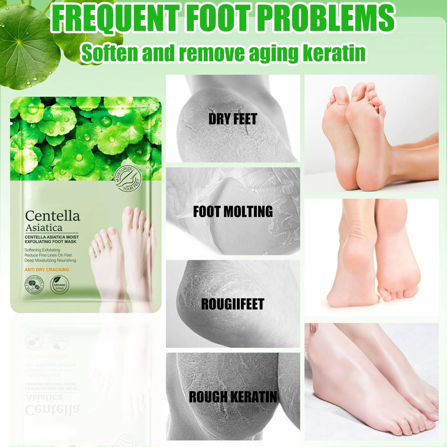 Masque Pieds Hydratant Chaussettes Centella Asiatica Soin Pieds Adoucissant Peeling Doux Talons Secs Fendillés