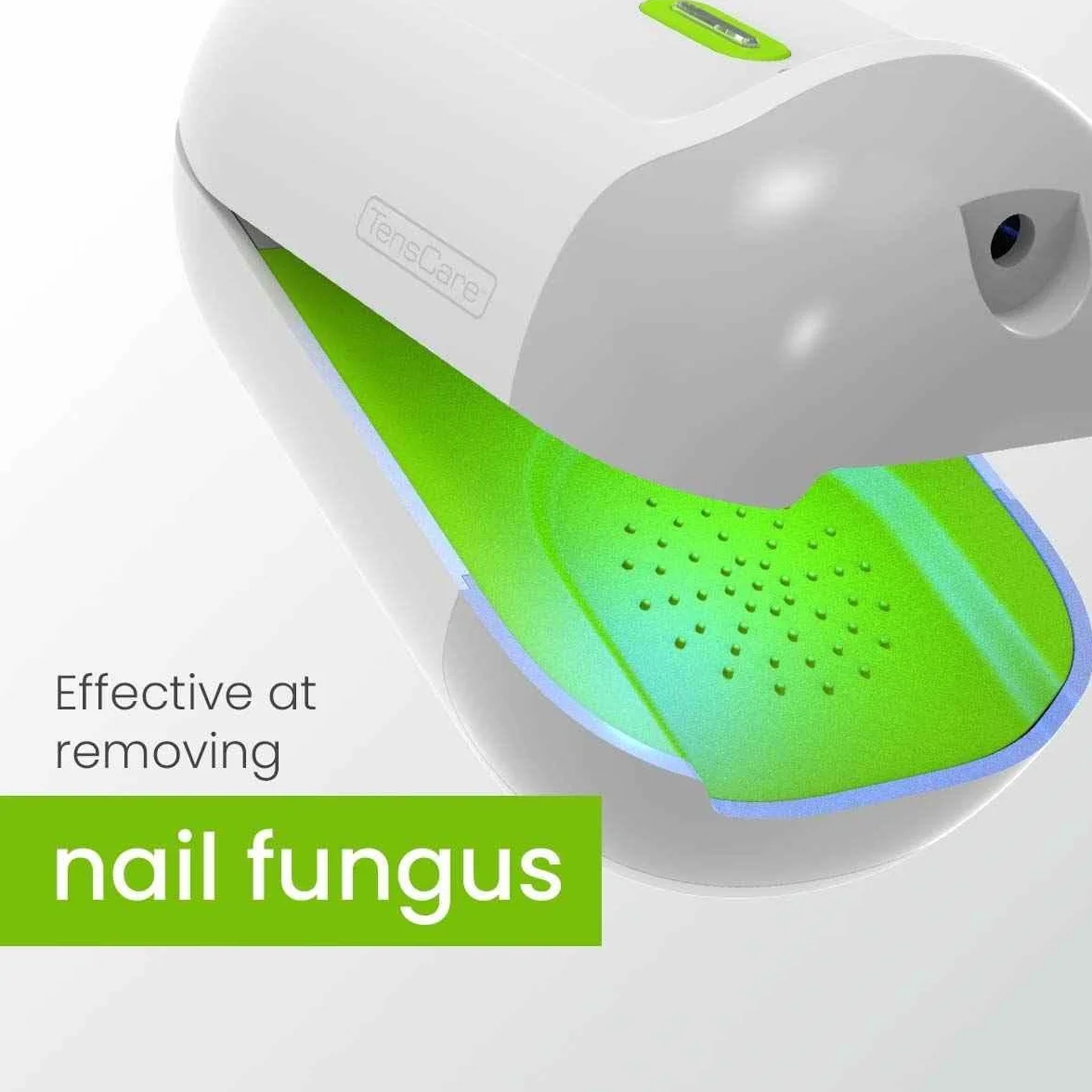 TensCare Nailit Laser Nettoyage et Soin des Ongles
