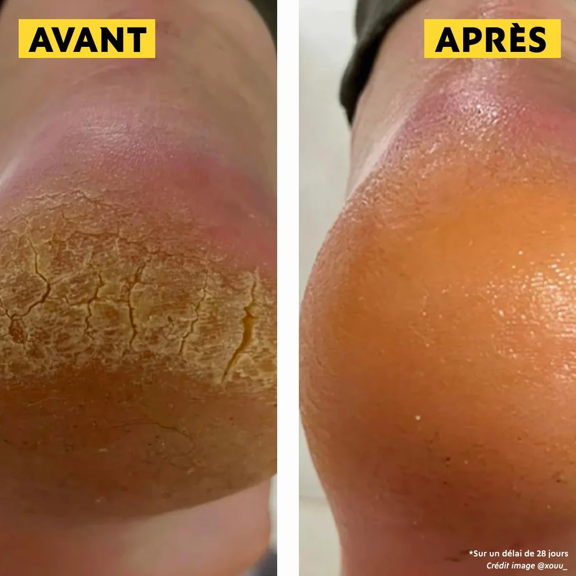 Alvadiem Onguent Réparateur Gelée Royale Baume Crevasses Mains Pieds 50 ml