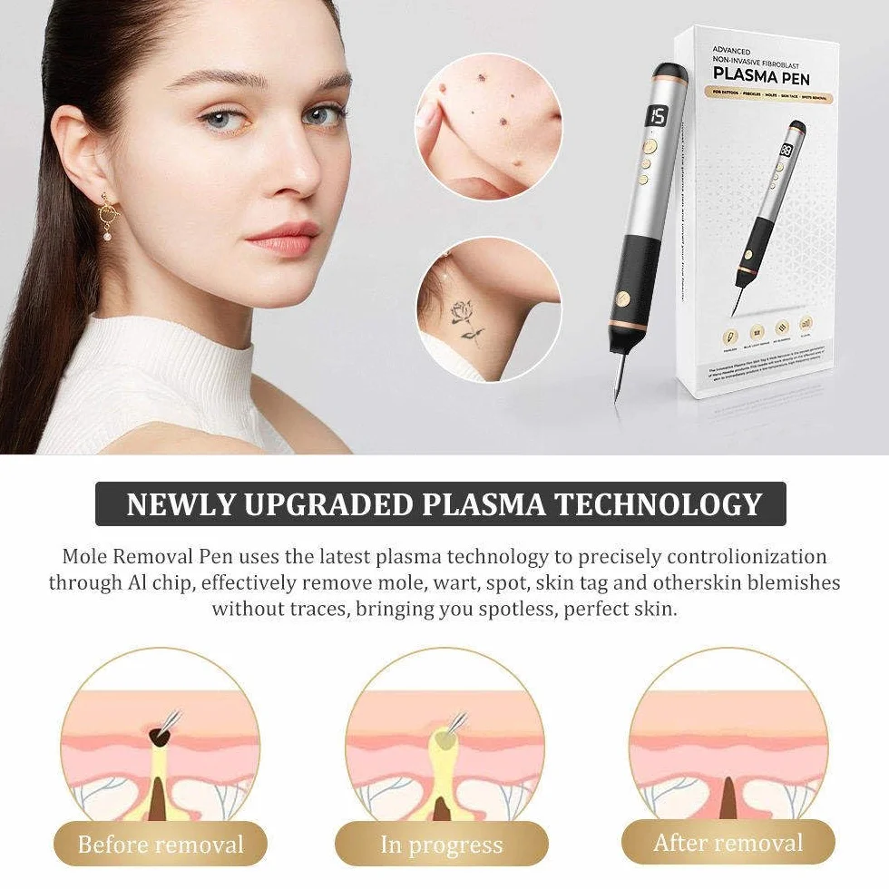 Stylo Laser Plasma à 15 Niveaux Pour L'élimination Des Verrues,Grains De Beauté,Taches,Taches De Rousseur Et Nævus Sur Les Lèvres,Les Mains,Les Yeux,Le Visage,La Tête Et Le Nez, Sûr Et Indolore