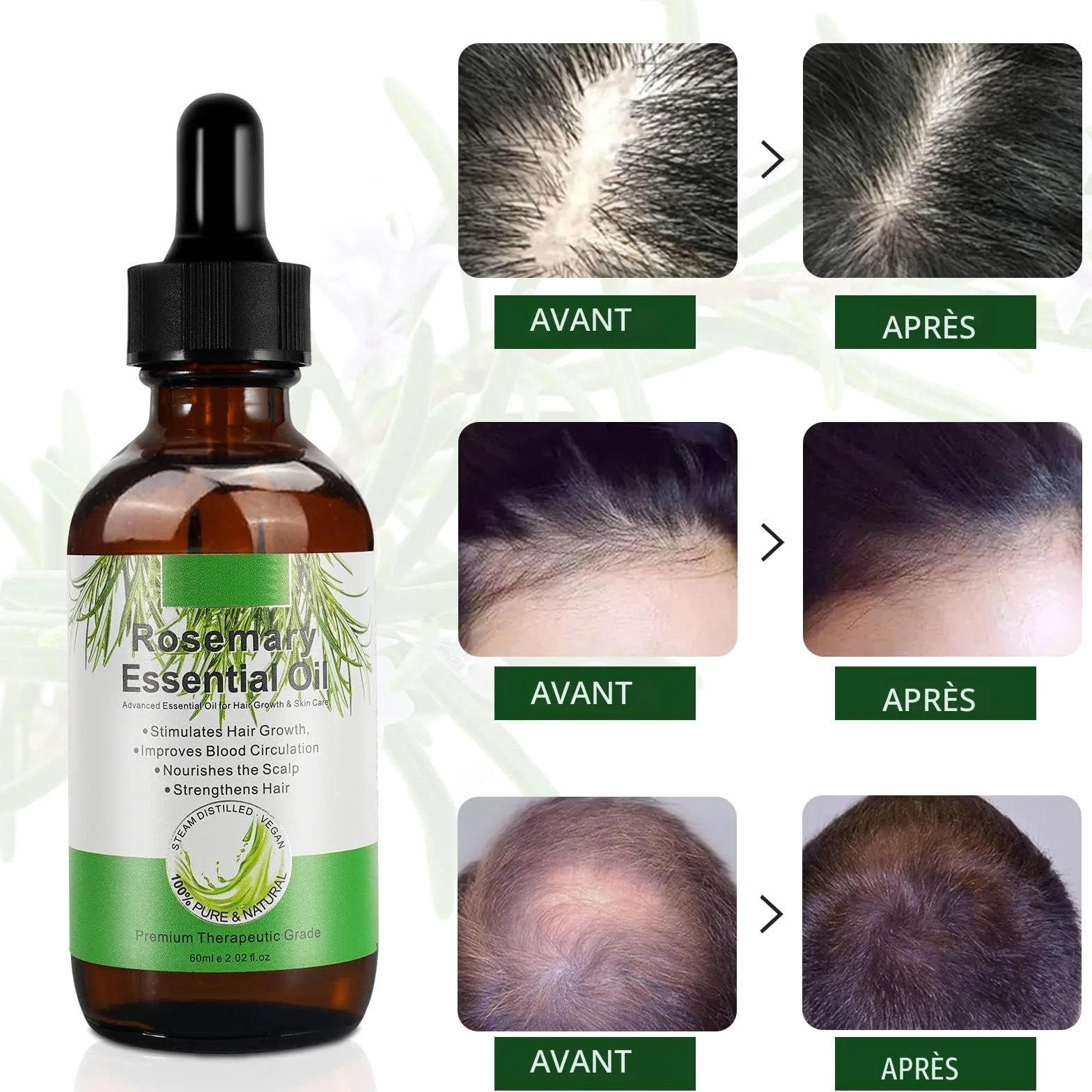 Huile Essentielle de Romarin 100% Pure pour Croissance des Cheveux et Soins de la Peau 60ml (Pack de 2)