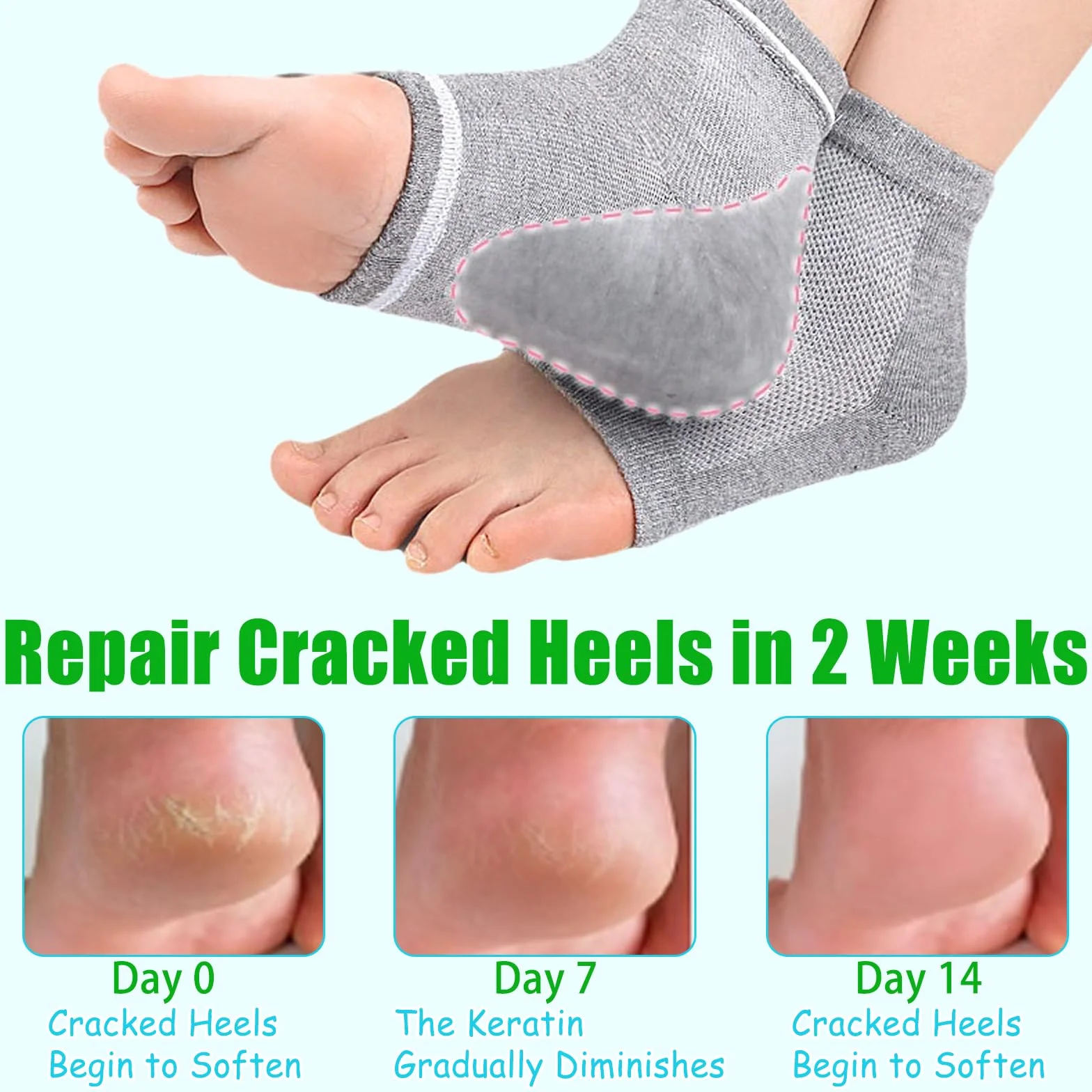 Chaussettes Hydratantes Réutilisables Talon en Gel Ventilé à Bout Ouvert Silicone Souple pour Pieds Secs et Craquelés