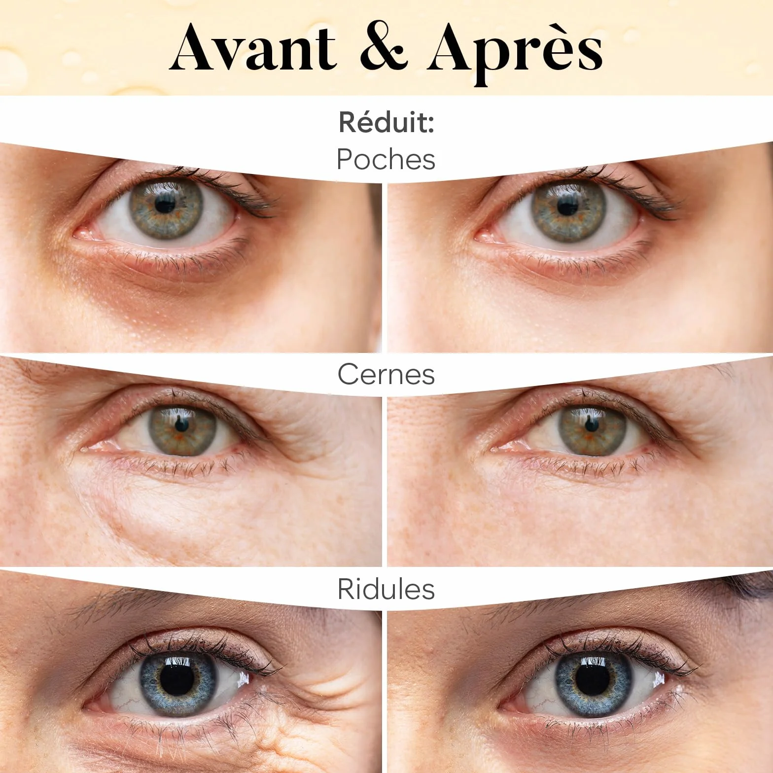 AURAE Masque Yeux Anti Cernes Vitamine C Caféine 30 Paires