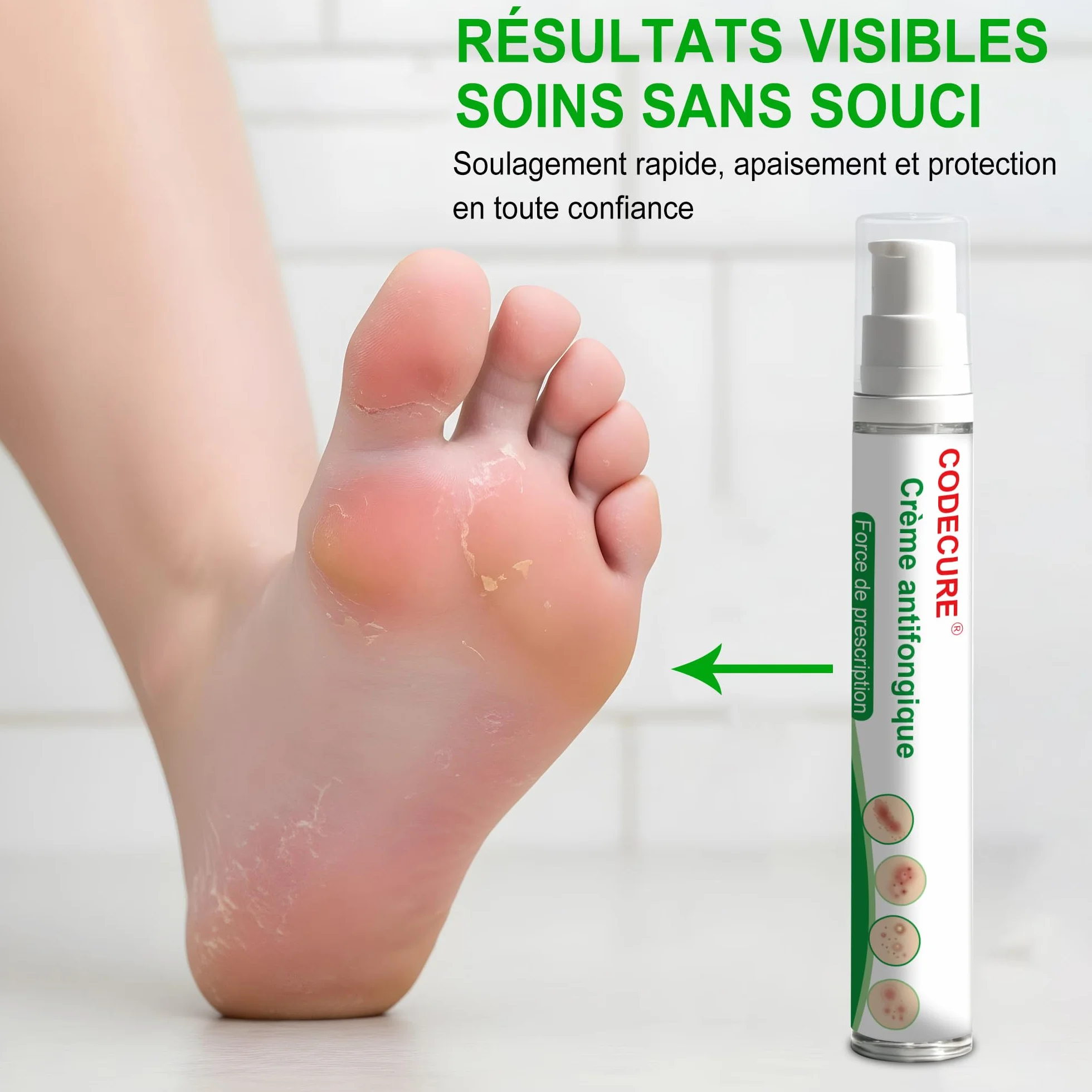 Crème antifongique pour la peau, pied d'athlète, démangeaisons et teigne - Formule douce, 18g