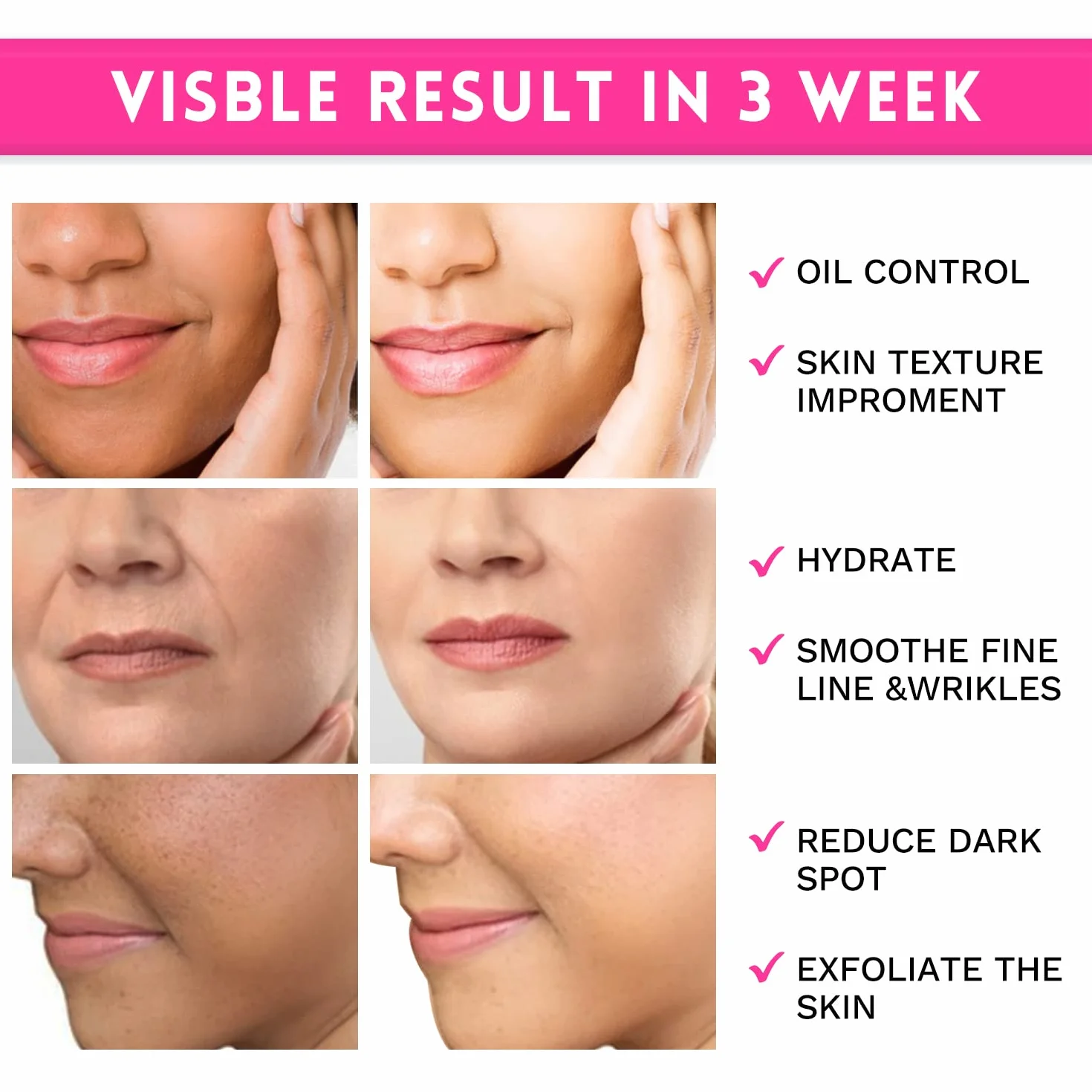 Coussinets Exfoliants AHA à l'Acide Glycolique pour le Visage, 80 Pièces avec Vitamines B5, C & E