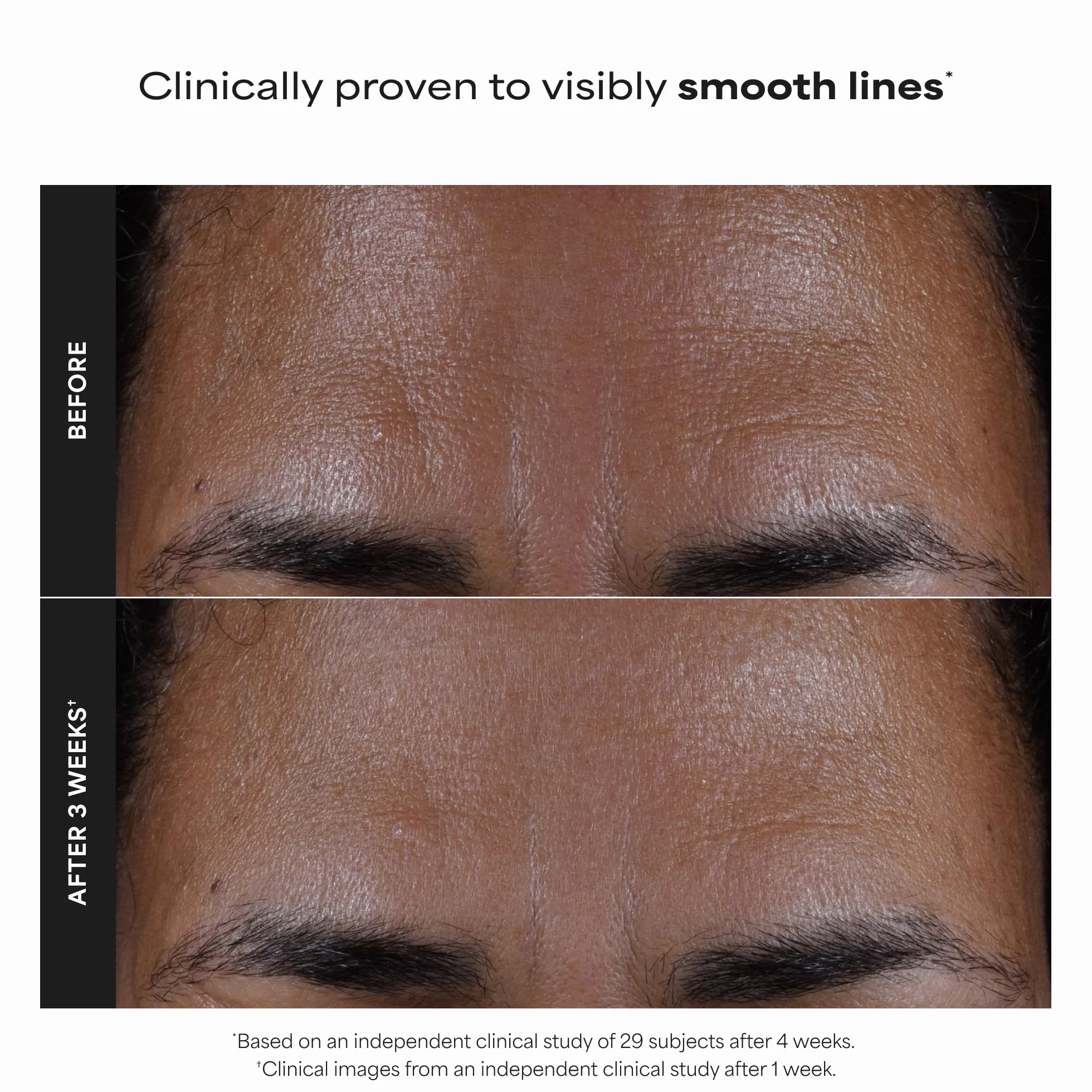 Paula's Choice SKIN PERFECTING 2% BHA Lotion Exfoliante Acide Salicylique 30 ml