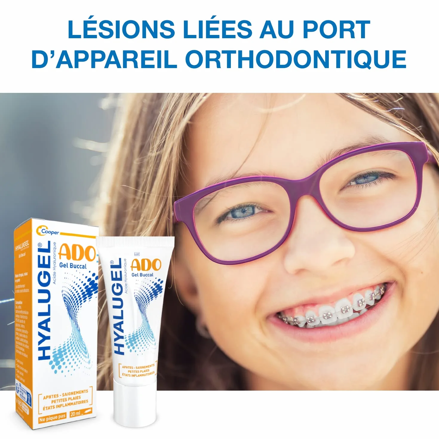 HYALUGEL Gel buccal Acide Hyaluronique 20 mL Lésions orthodontique Aphtes