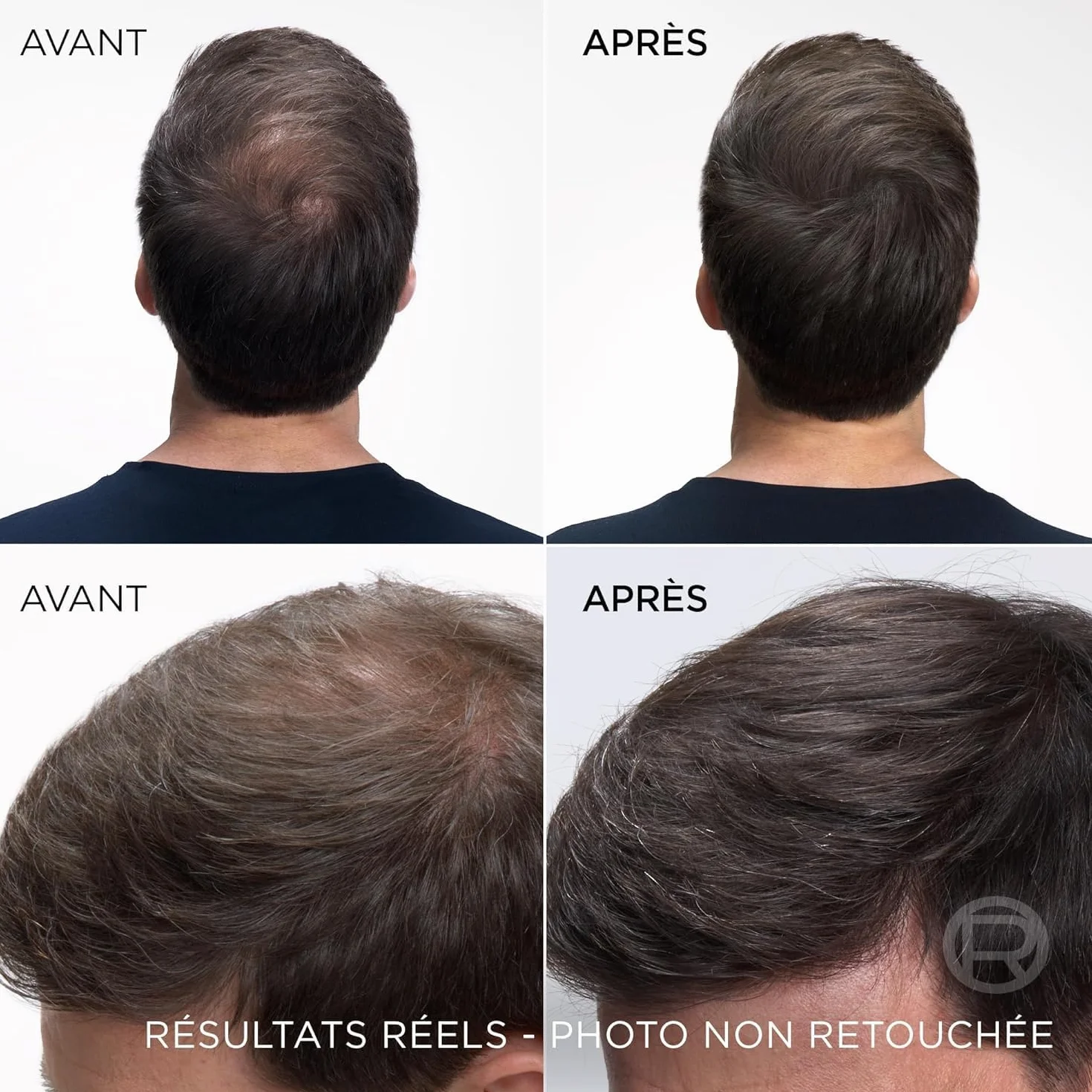 L’ORÉAL PARIS Magic Retouch Spray Correcteur Racines Cheveux Blancs Châtain Foncé 75ml