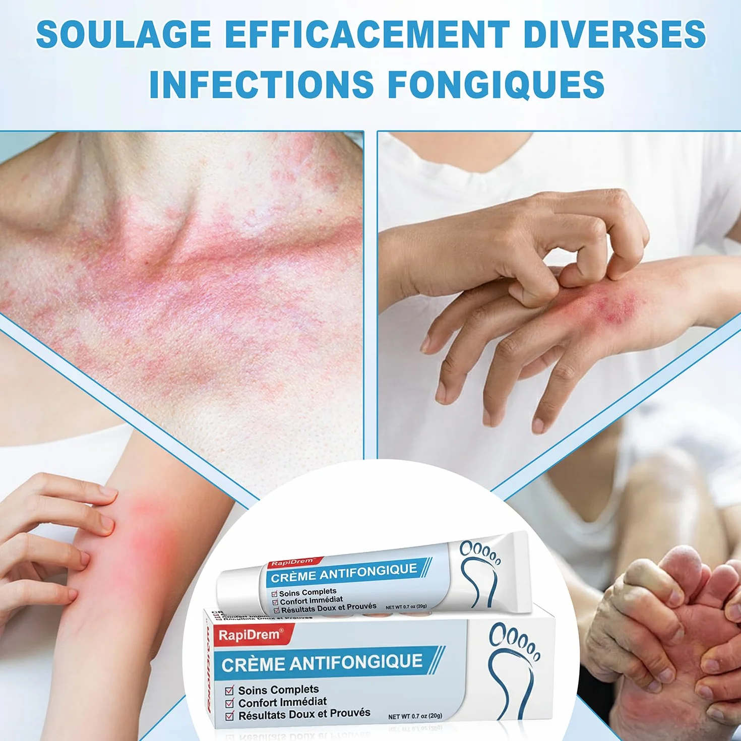 Crème Antifongique 20g - Soin Peau Mycose Pied