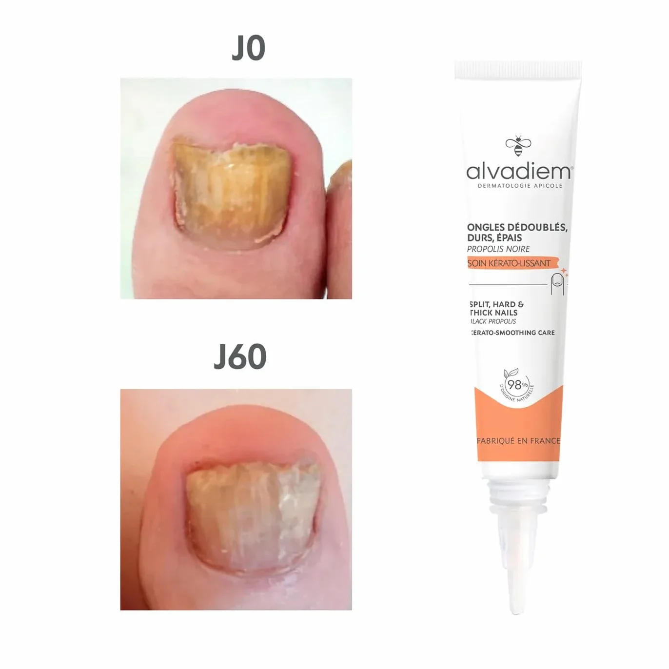 Alvadiem | Soin Ongles Kérato-Lissant à la propolis noire | Ongles durs, épais, psoriasis | Affine & restructure les ongles durs & épais | Lutte contre l’oxydation | Fabriqué en France | 10ml