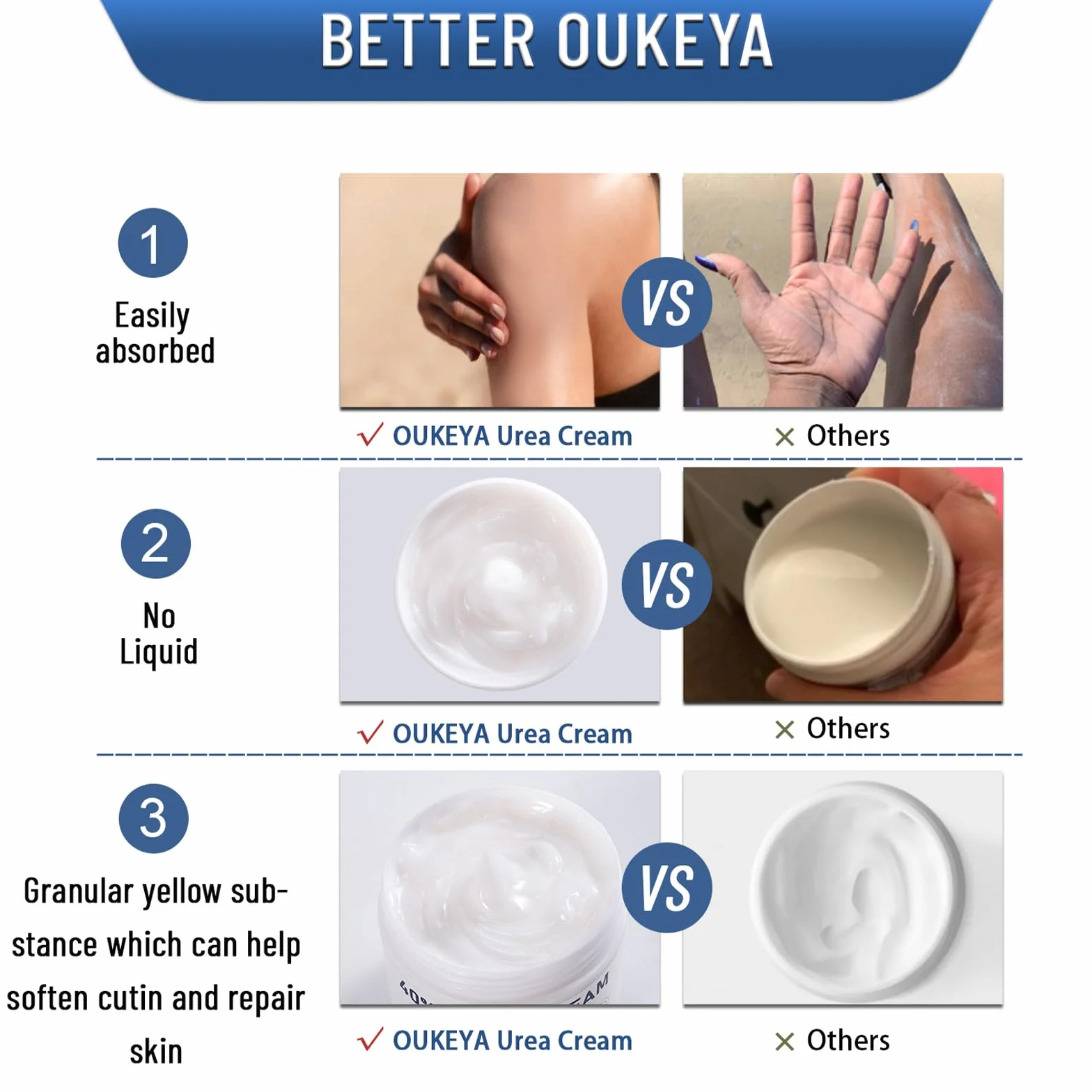 OUKEYA Crème d'Uree 40% Réparatrice Hydratante Mains Pieds Crevasses Gerçures Engelures Soins Intenses Nourrissante Corps