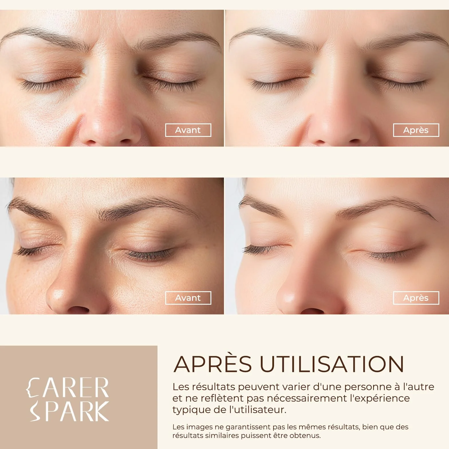 CARER SPARK Épurateur de Peau Ultrasonique - Spatule Visage à Ultrasons EMS Ions Lumière Rouge et Bleue, 4 Modes pour Nettoyage en Profondeur Élimination des Points Noirs Exfoliation Douce