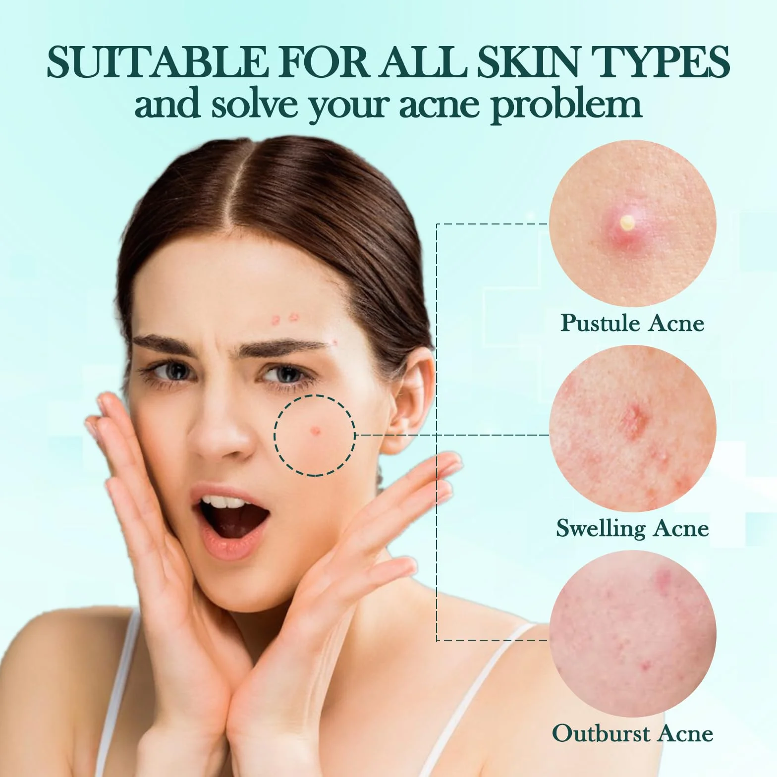 Patch Bouton Etoile Hydrocolloïde Anti Acné Invisible 408 PCS avec Huile Tea Tree Acide Salicylique