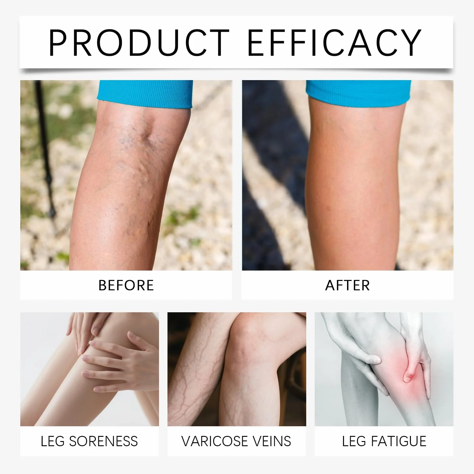Leg Renew Varicose Vein Patch 60pcs Vein Target Microneedle Patch Natural Ingredients All Skin Types