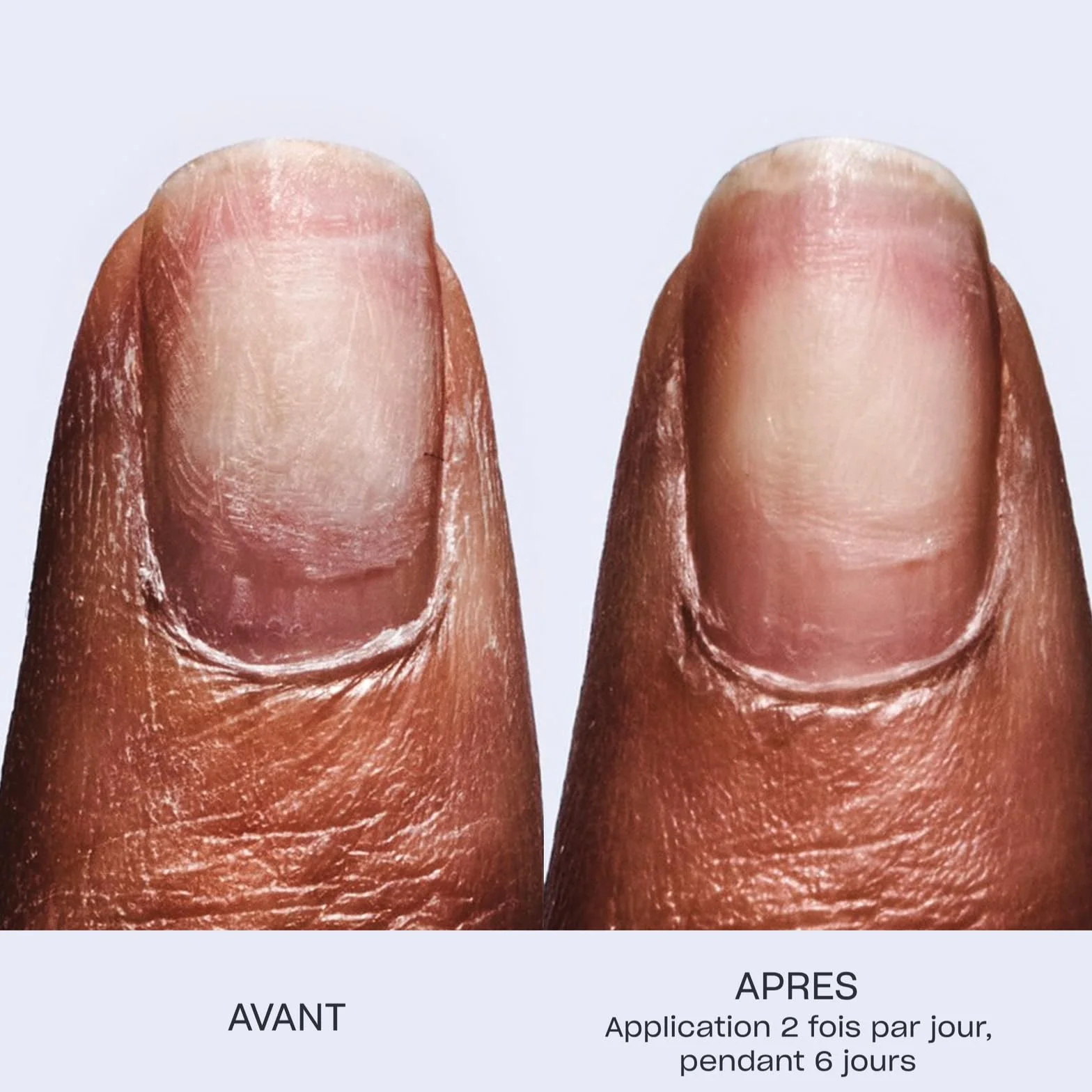 OPI Repair Mode - Sérum Restructurant pour les Ongles fragiles & endommagés - Formule Vegan - Agit en profondeur pour réparer la kératine naturelle des ongles - 9ml Blanc