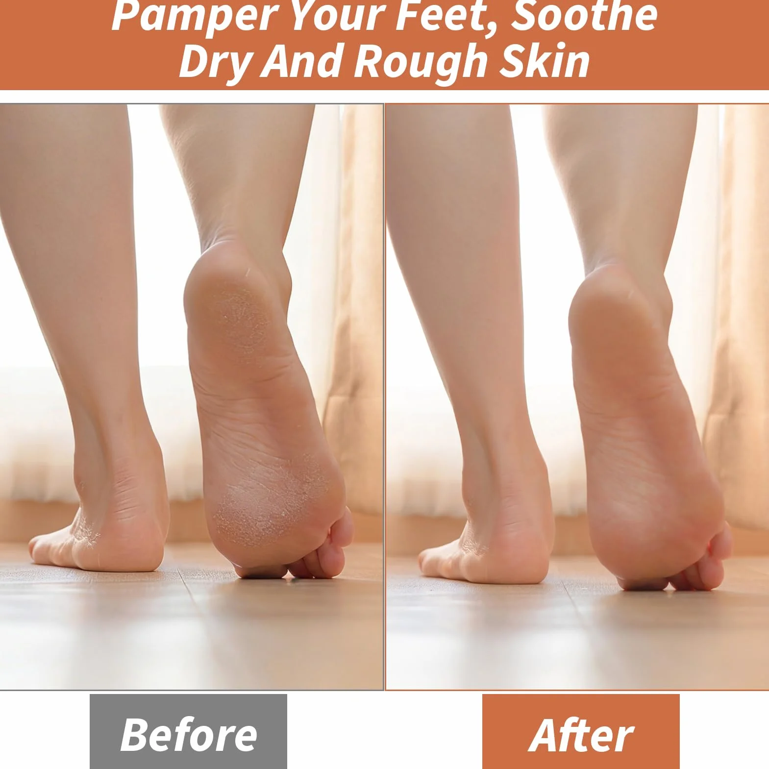 Lot de 8 paires de chaussettes hydratantes en gel spa antidérapantes blanches pour pieds secs et callosités