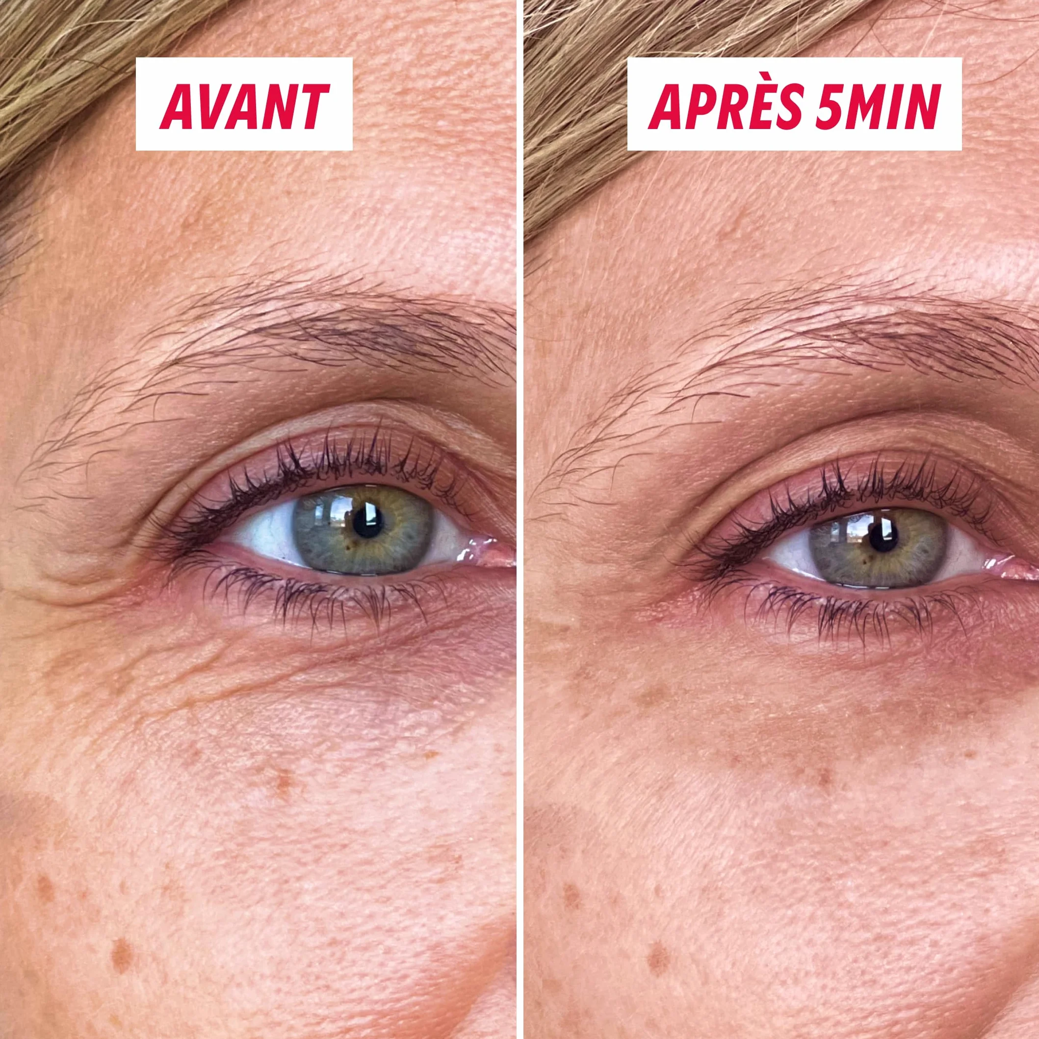 MYSOSBEAUTY Combleur de Rides Correcteur Poches et Rides Crème Liftante Contour des Yeux Anti-Age 8 ml