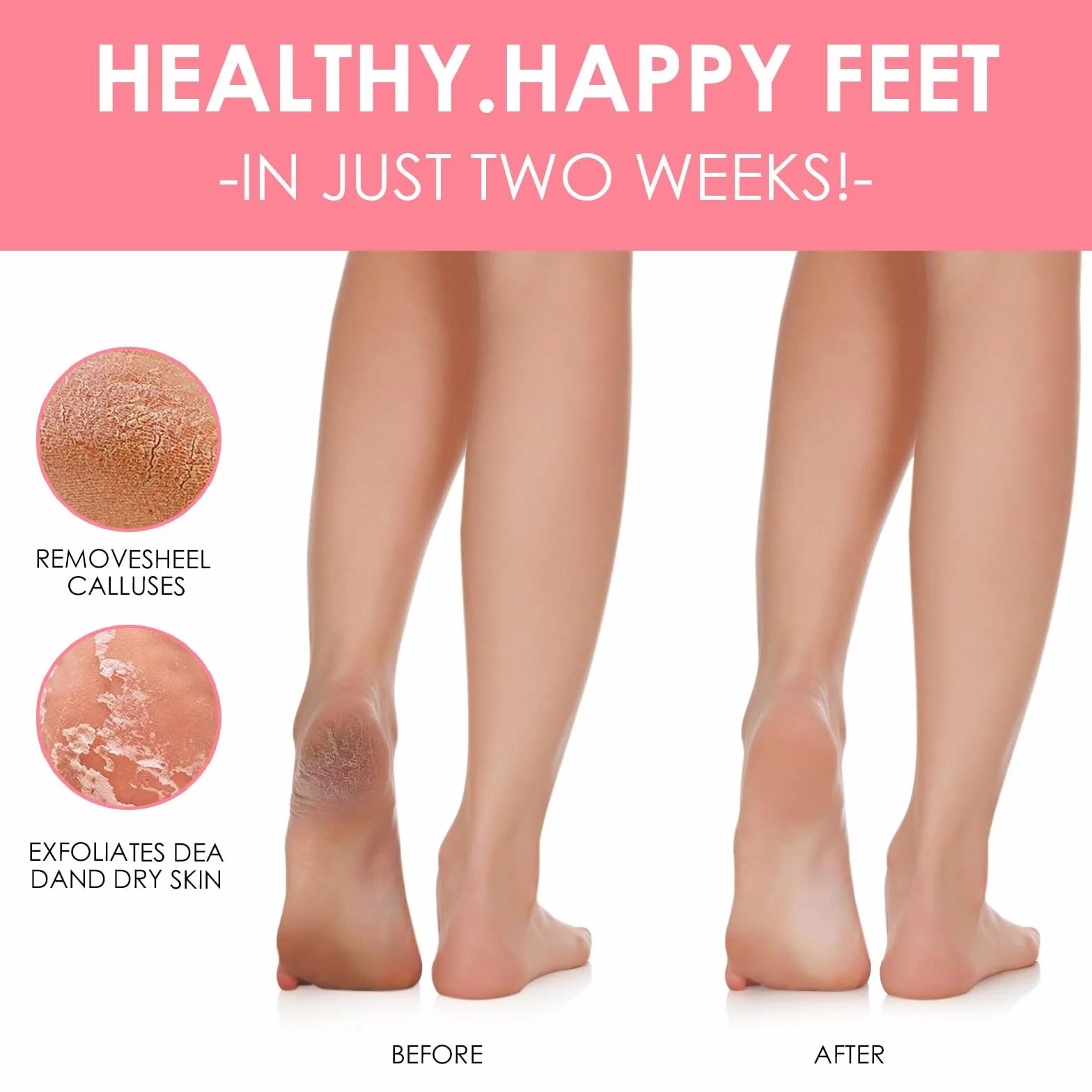 Masque Pieds Peeling Exfoliant pour Femmes & Hommes, Fraise Pêche