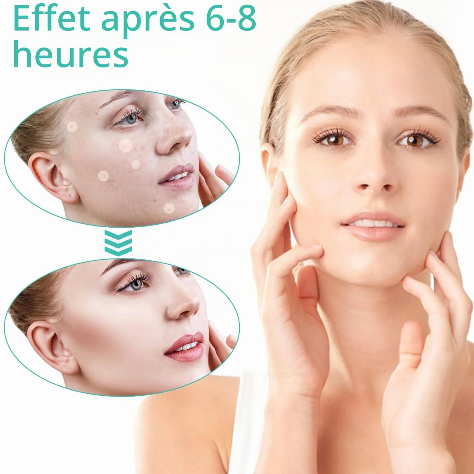 Patch Bouton 200 Patchs – Pimple Patch Invisible Jour & Nuit, Anti-Acné Hydrokolloïde, Sans Parfum, Végan