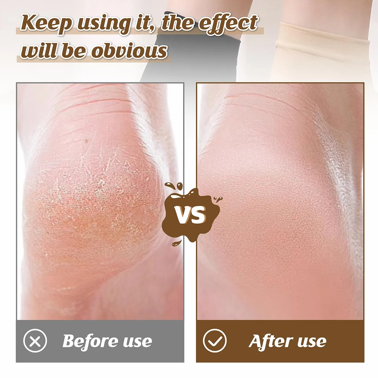 Chaussettes Hydratantes pour Talons en Gel Réutilisables - Traitement Talons Secs et Crevassés (Noir, Kaki)