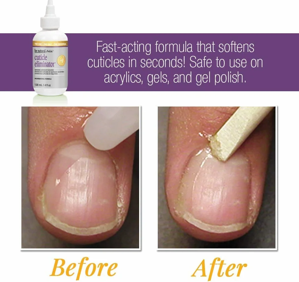 Prolinc Be Natural Cuticle Eliminator 4oz 118ml