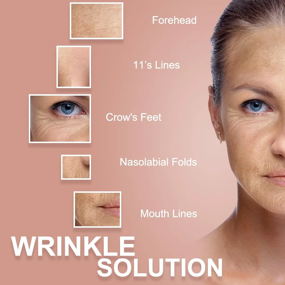 Akissos Face Tape Bande de Kinesiologie Visage Lift Anti Wrinkle Patches Neck Tape 2.5cm*5m