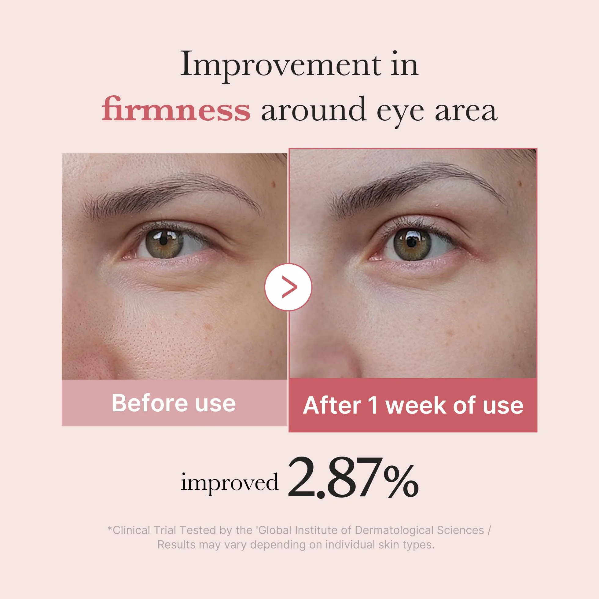 Medicube Salmon DNA PDRN Pink Peptide Eye Serum 1.01 fl.oz – Sérum yeux Niacinamide Rétinol pur – Rides fines teint irrégulier