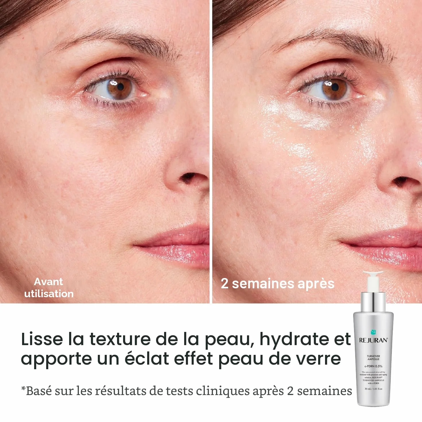 REJURAN Ampoule Turnover Sérum Visage Pdrn Original Salmon Dna Rajeunissement Fermeté Hydratation Éclat Jeunesse 30 Ml