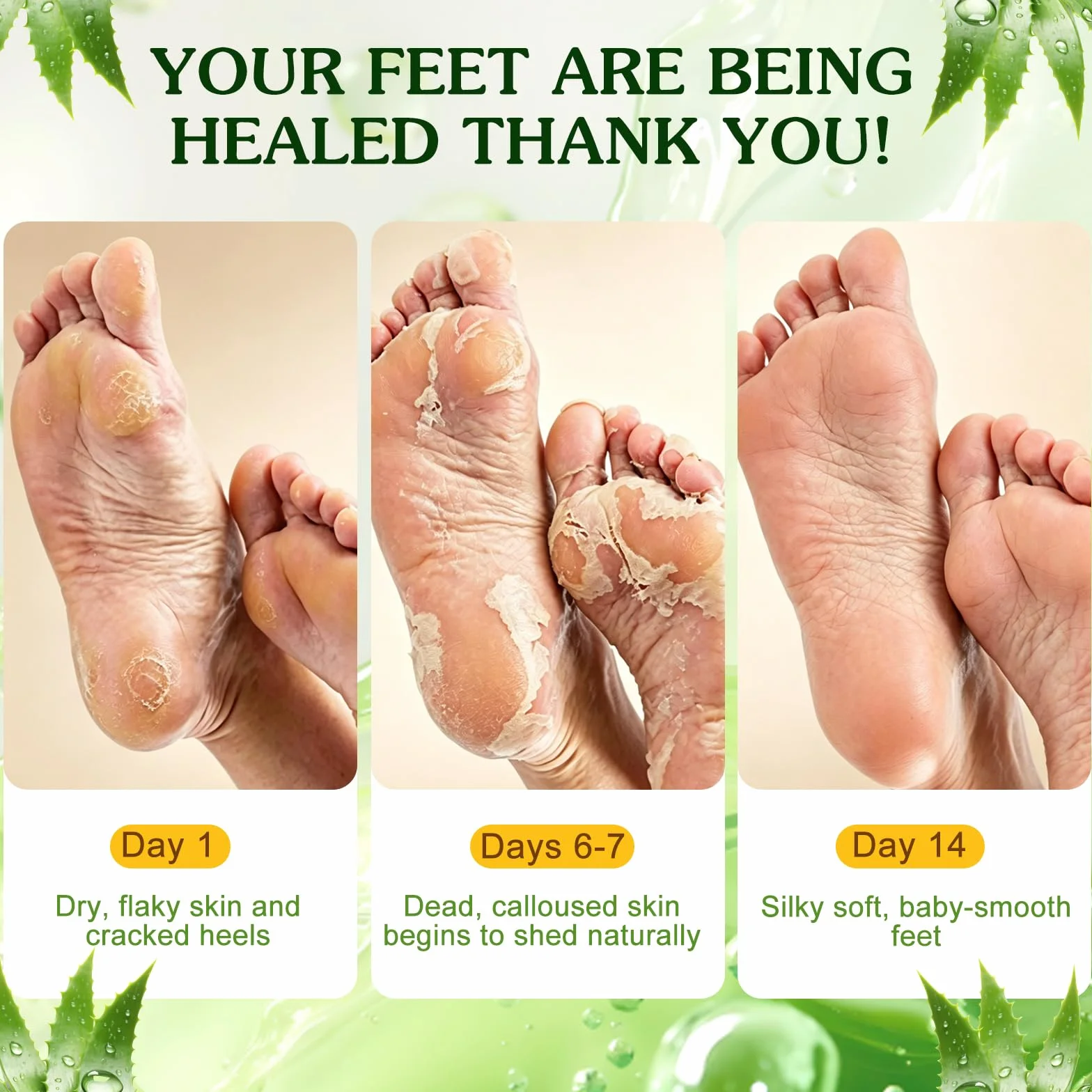 Chaussettes Exfoliantes Pedi-Peeling pour Peaux Sèches, Gommage Callus Soin Peau Morte, Hydratant et Nourrissant, Aloe Vera