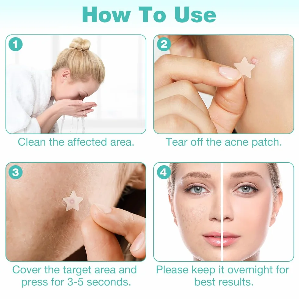 Pimple Patches 400 pièces, Patch Bouton Huile Tea Tree Acide Salicylique Hydrocolloïde Acné Visage