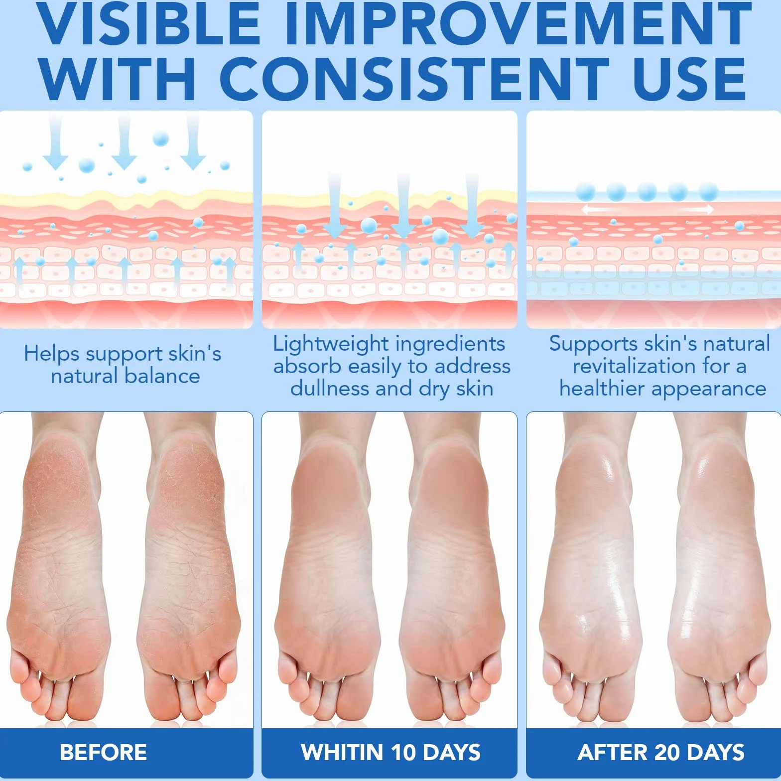 Crème pour les pieds 60% urée + 2% acide salicylique éliminateur de callosités exfoliant hydratant talons gercés (1 Pack)