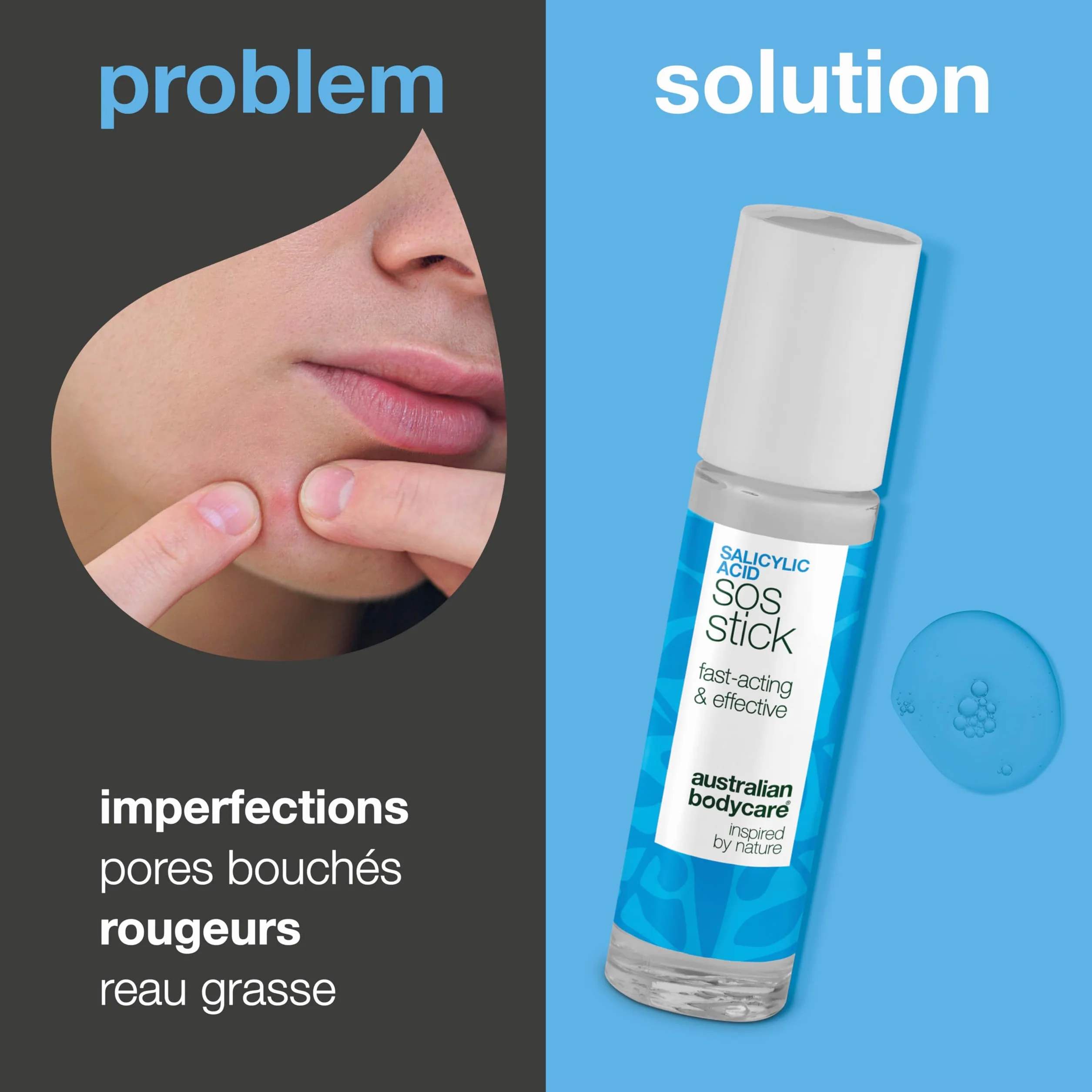 Stick SOS à l’acide salicylique pour boutons et points noirs – traitement rapide peau nette