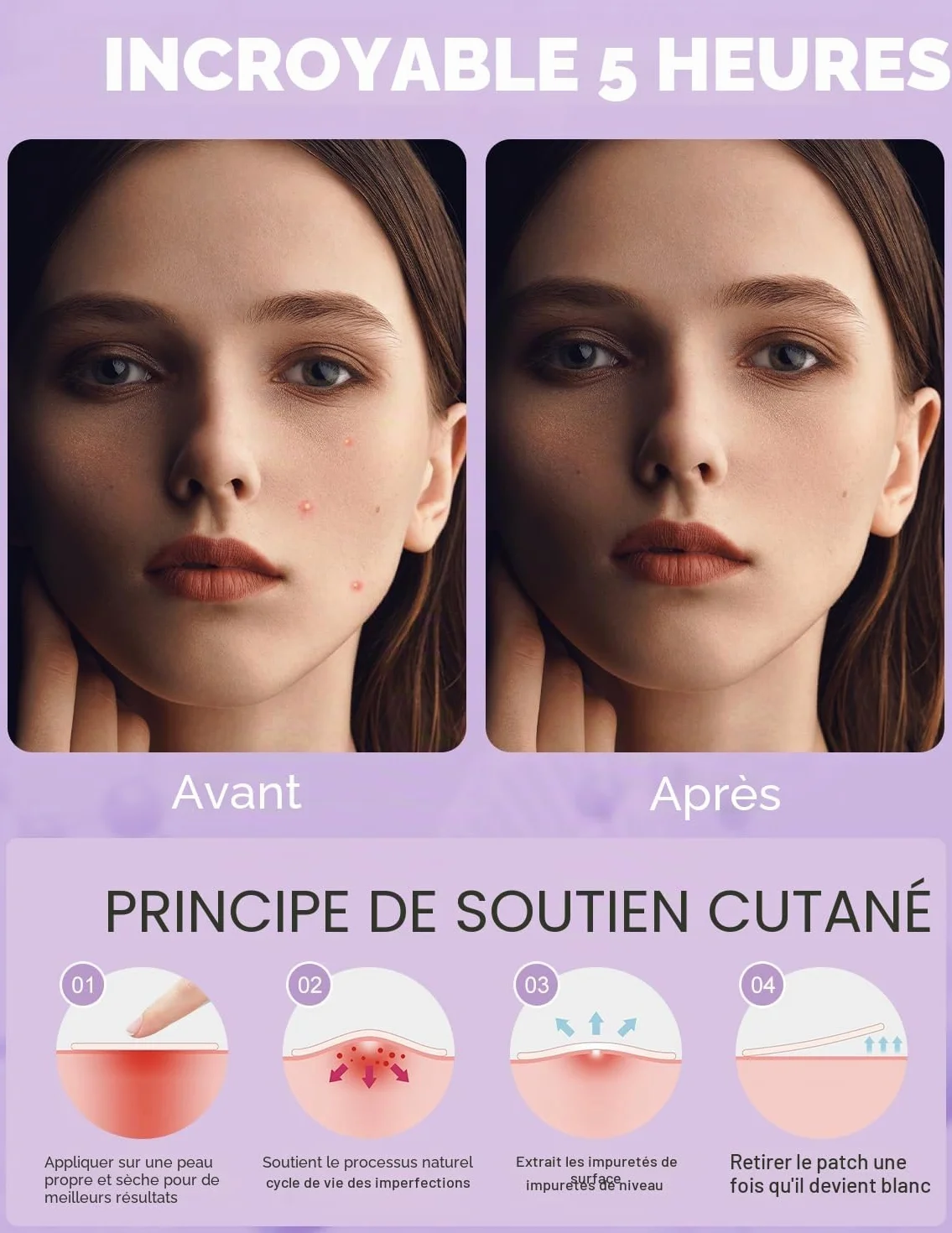 Pimple Patch Hydrocolloïdes Anti Bouton 108 pcs 5 tailles 8/10/12/14/16 mm Transparent CICA Acide Salicylique