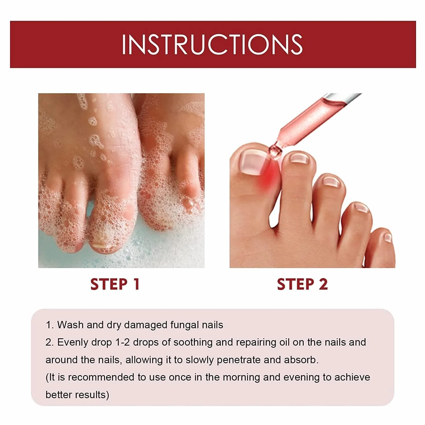 German Toenailplus Anti Paronychia Relief Oil, Paronychia Treatment for Toe and Fingernail Repair (2pcs)