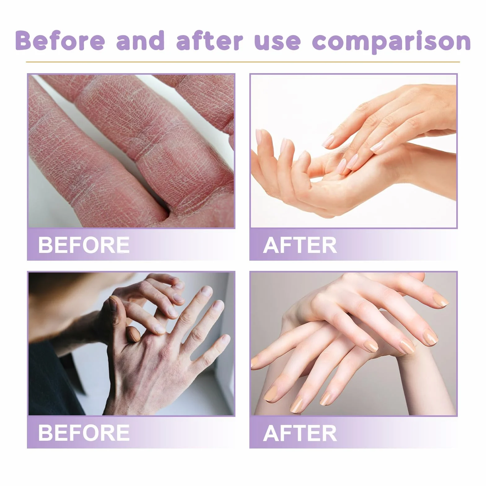 Masque pour Les Mains 6 Paires Gants Hydratants Exfoliants Peaux Sèches Anti-âge