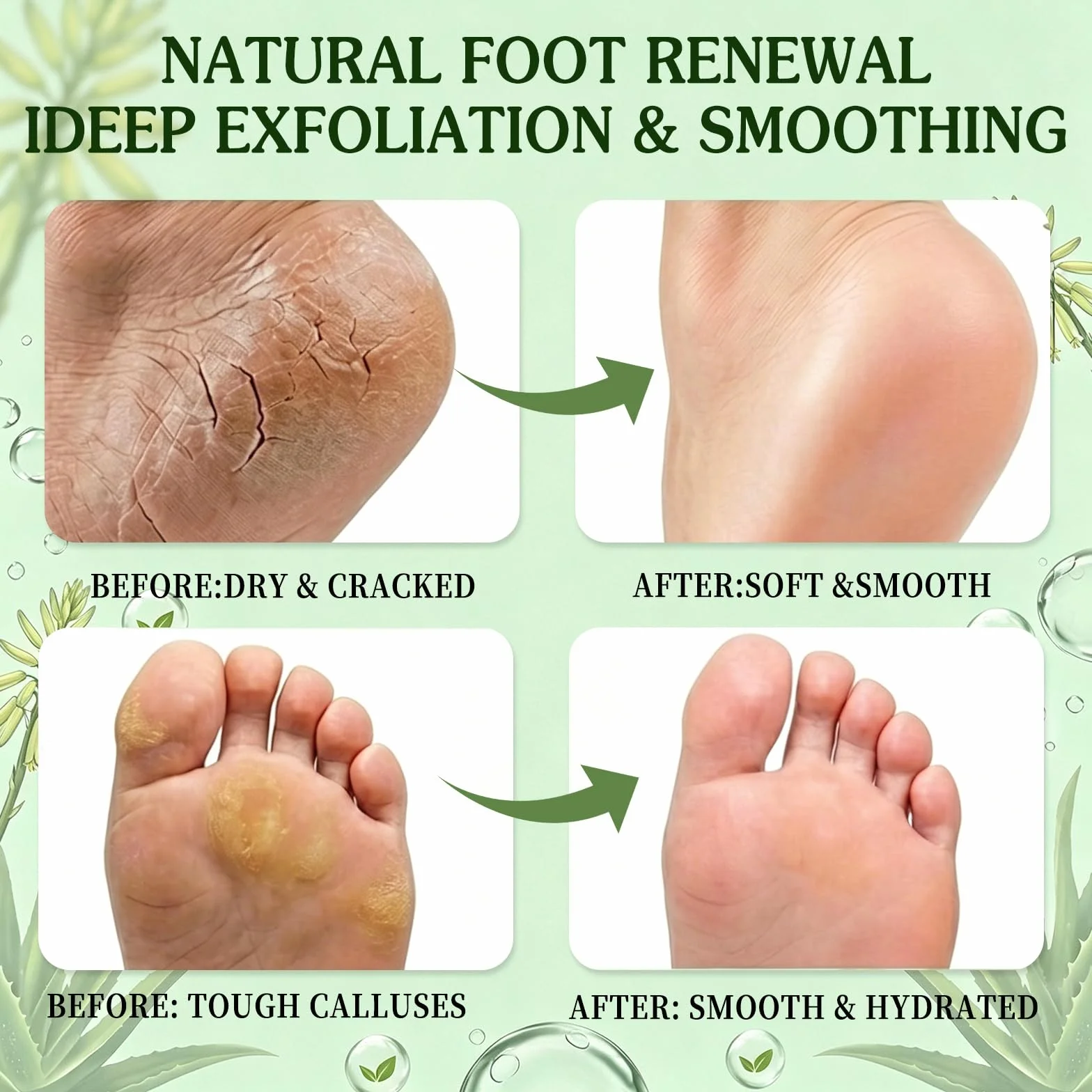 Chaussettes Exfoliantes Pedi-Peeling pour Peaux Sèches, Gommage Callus Soin Peau Morte, Hydratant et Nourrissant, Aloe Vera