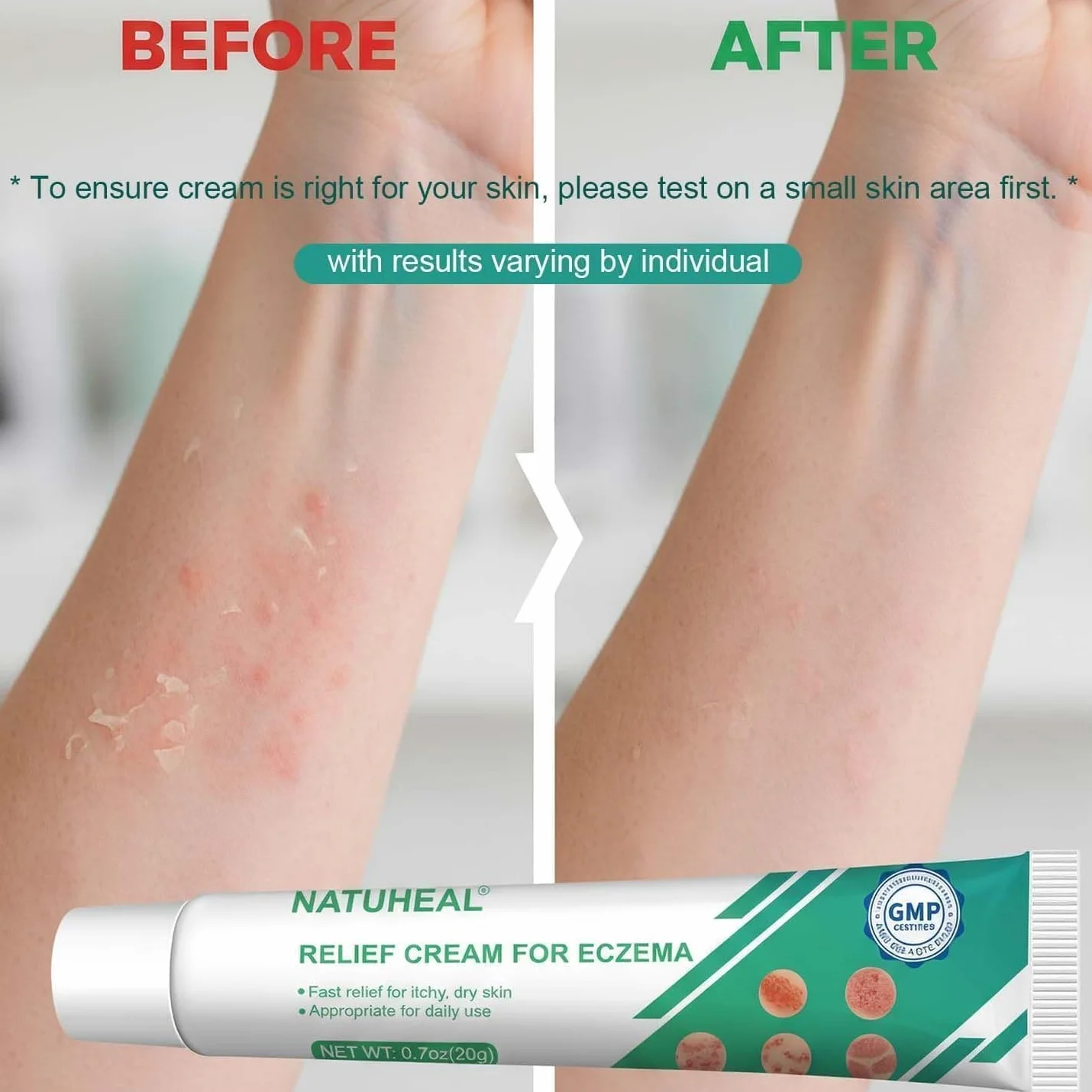 Crème Anti-Démangeaisons Eczéma Apaisante Réparatrice Peaux Sèches Irritées 20g