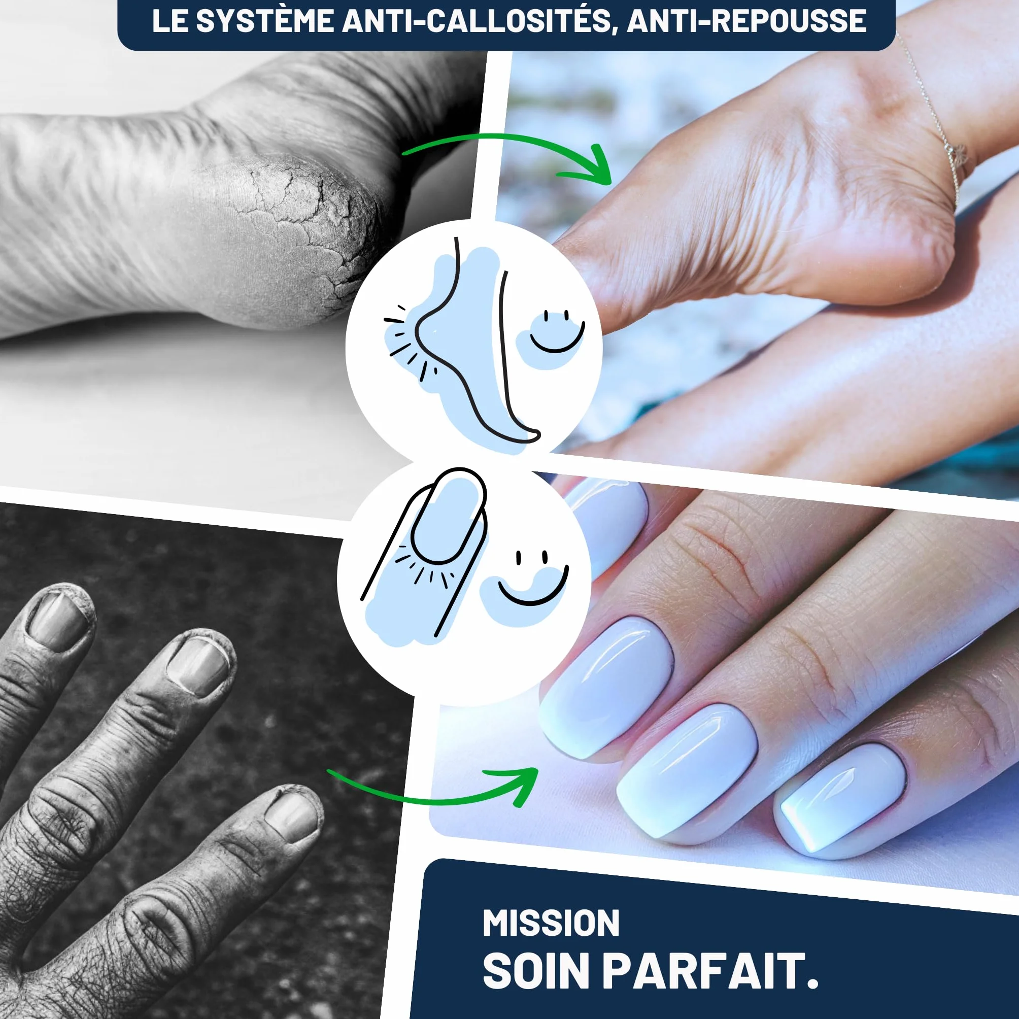 Mr. Fuss No. 1 Solution anti-callosités