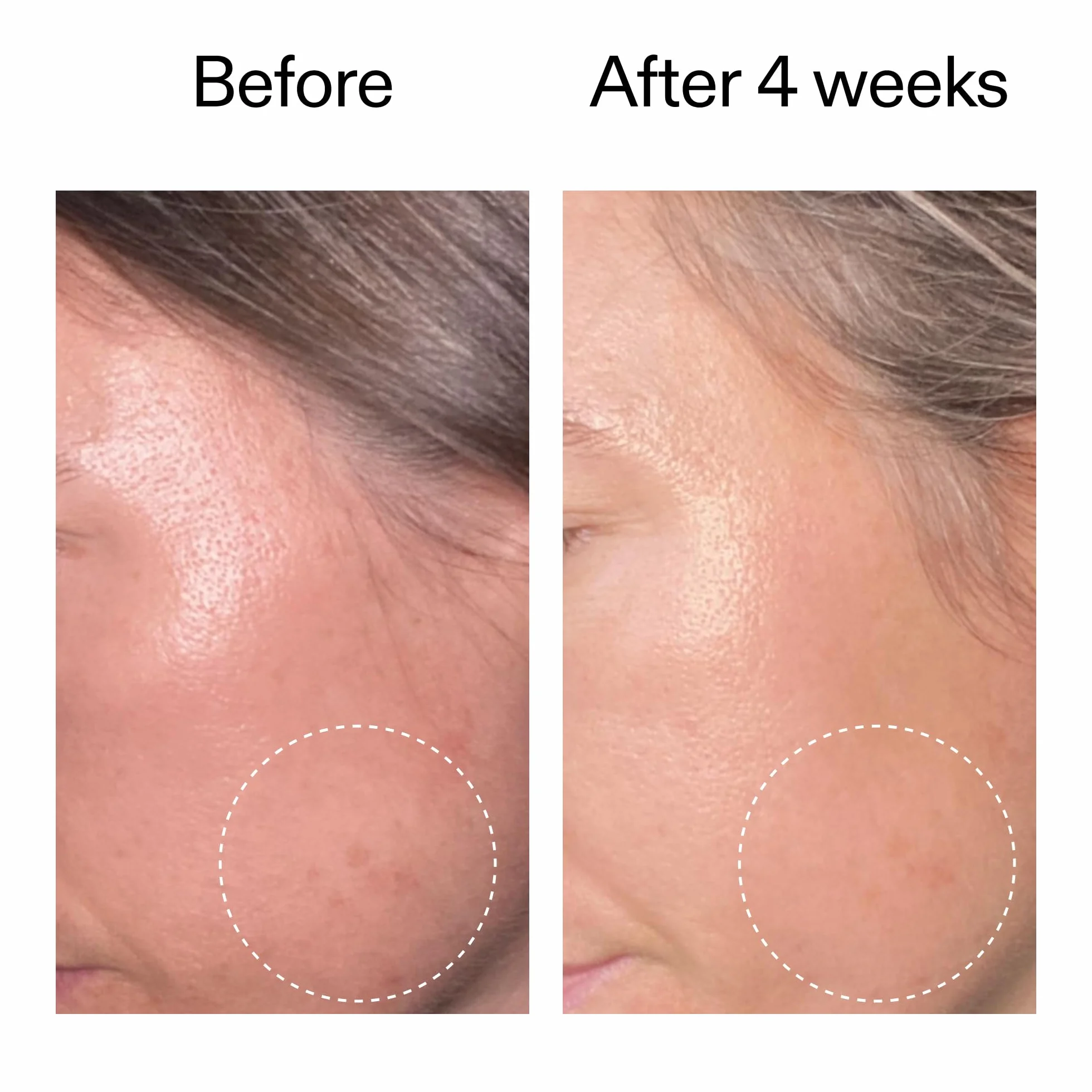 The INKEY List Advanced 0.2% Retinol Serum 15ml, Retinal, Sirtalice & Syrelief, Skin Renewal