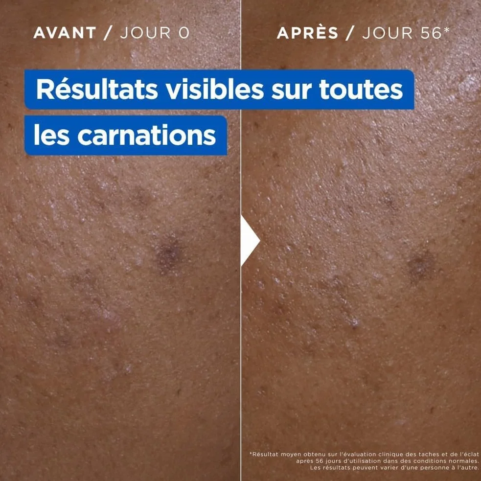 Mixa Crème Niacinamide Correction Éclat Hydratante Anti-Taches Beurre de Karité Vitamine C 400ml