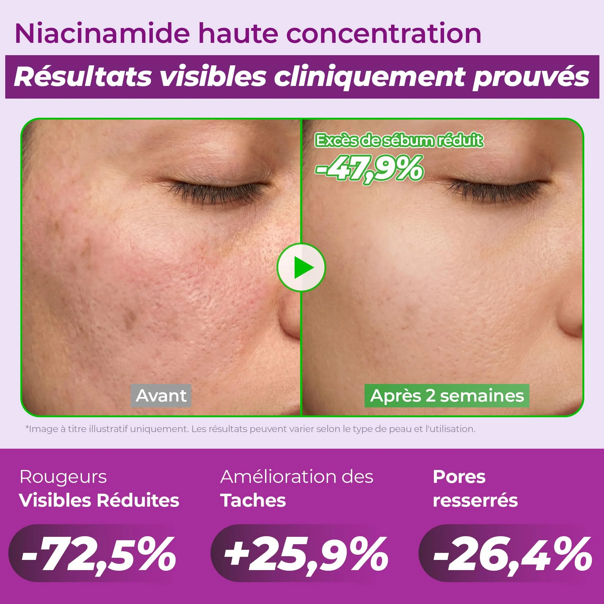 JUMISO Sérum anti-taches brunes 10 % niacinamide - TXA + glutathion - Sérum éclaircissant pour le visage pour un usage quotidien - Gel d'eau sans boulochage - Aide à unifier le teint de la peau