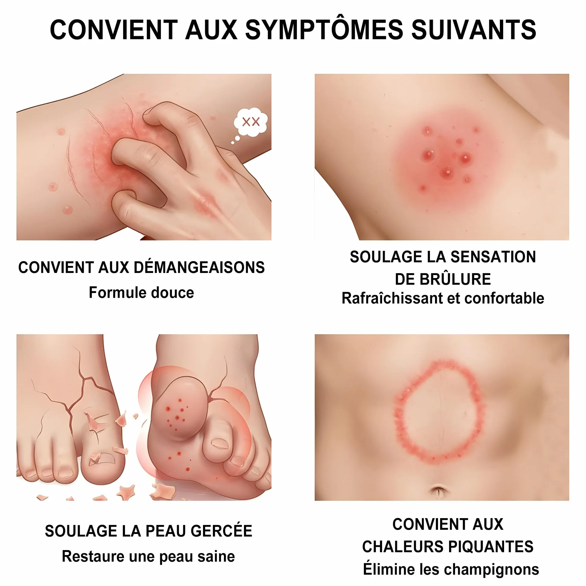 Crème antifongique pour la peau, pied d'athlète, démangeaisons et teigne - Formule douce, 18g