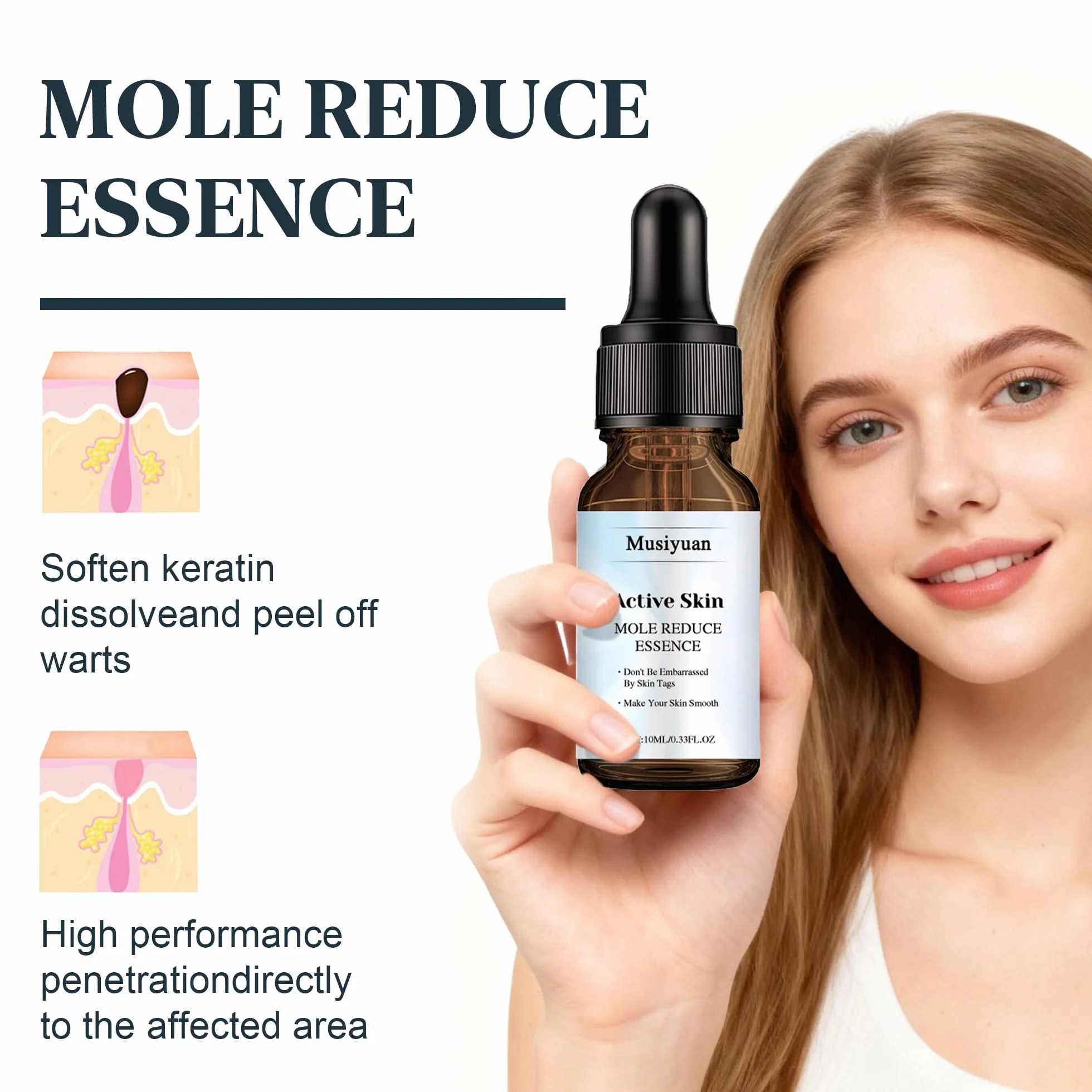 Anti Verrue Plantaire 10 ml | élimination Des Acrochordons | Soin Localisé pour Pieds et Mains