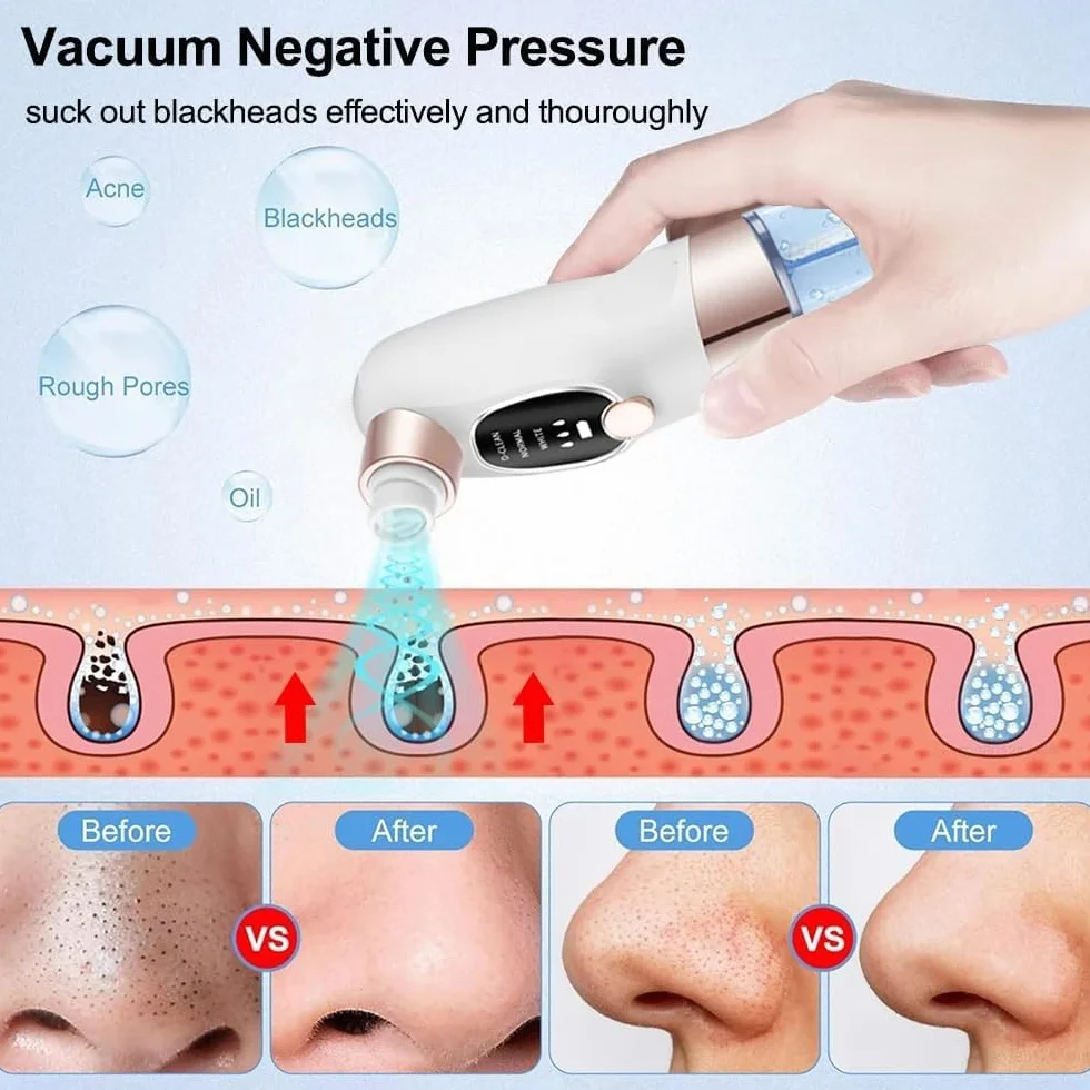 Aspirateur Point Noir Extracteur de Comédons Nettoyage des Pores avec 6 Sondes 3 Modes, Professionnel Extracteur de Point Noir Electrique Tire Nettoyant de Pores Soin Visage