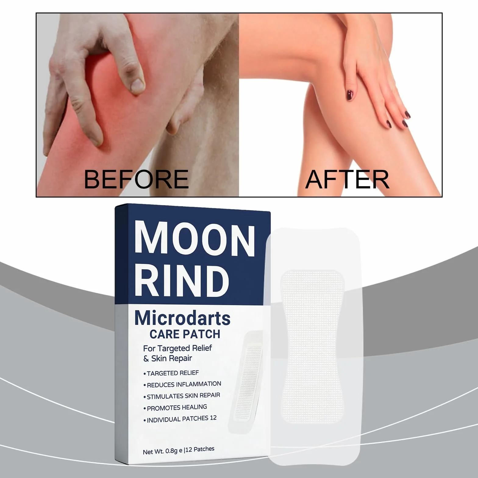 Leg Renew Varicose Vein Patch 60pcs Vein Target Microneedle Patch Natural Ingredients All Skin Types
