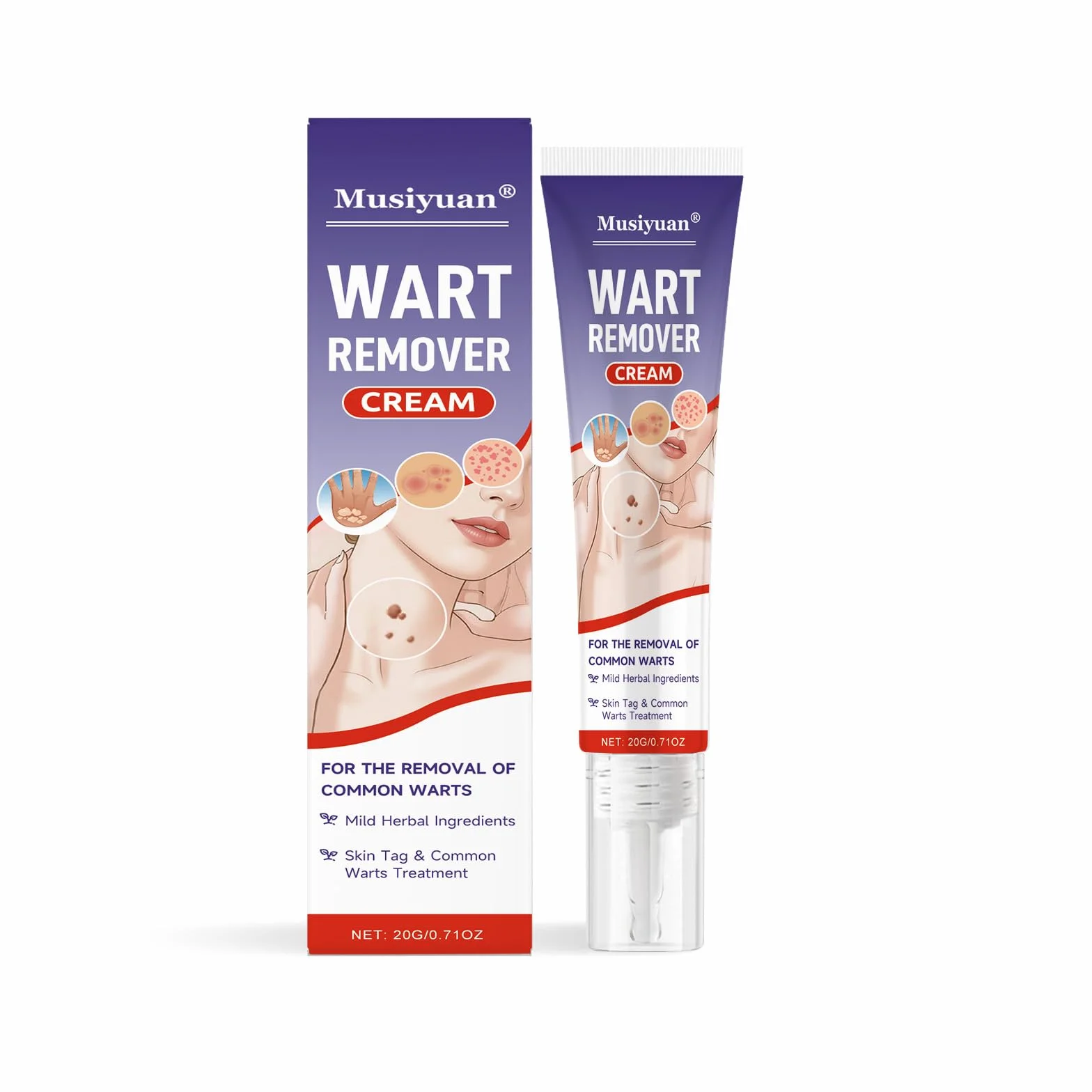 Crème anti-verrues 20 g élimine verrues communes et plantaires mains pieds corps