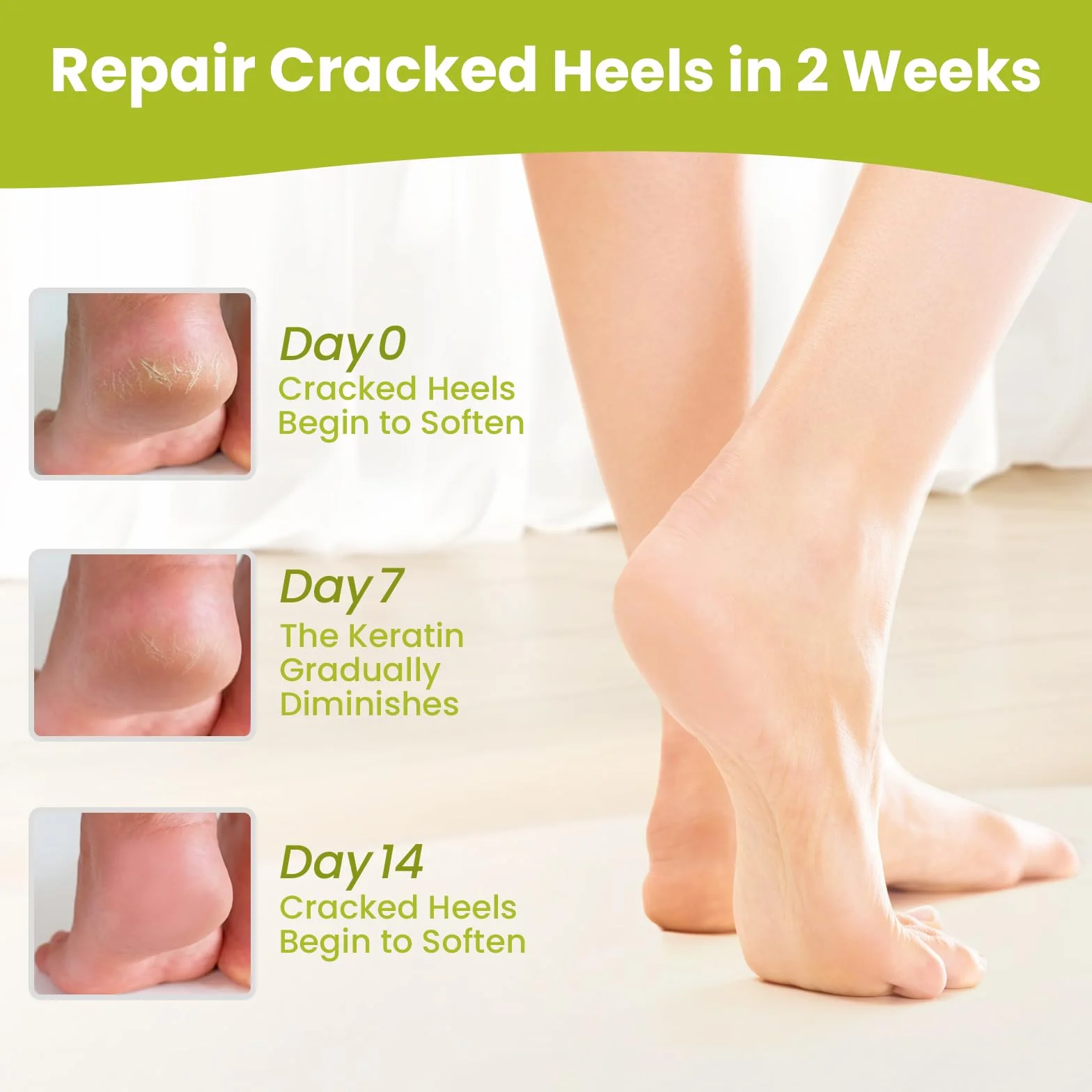 Chaussettes Hydratantes Réutilisables Bukihome, Chaussettes en Gel sans Orteils pour Talons Secs et Crevassés, Vert