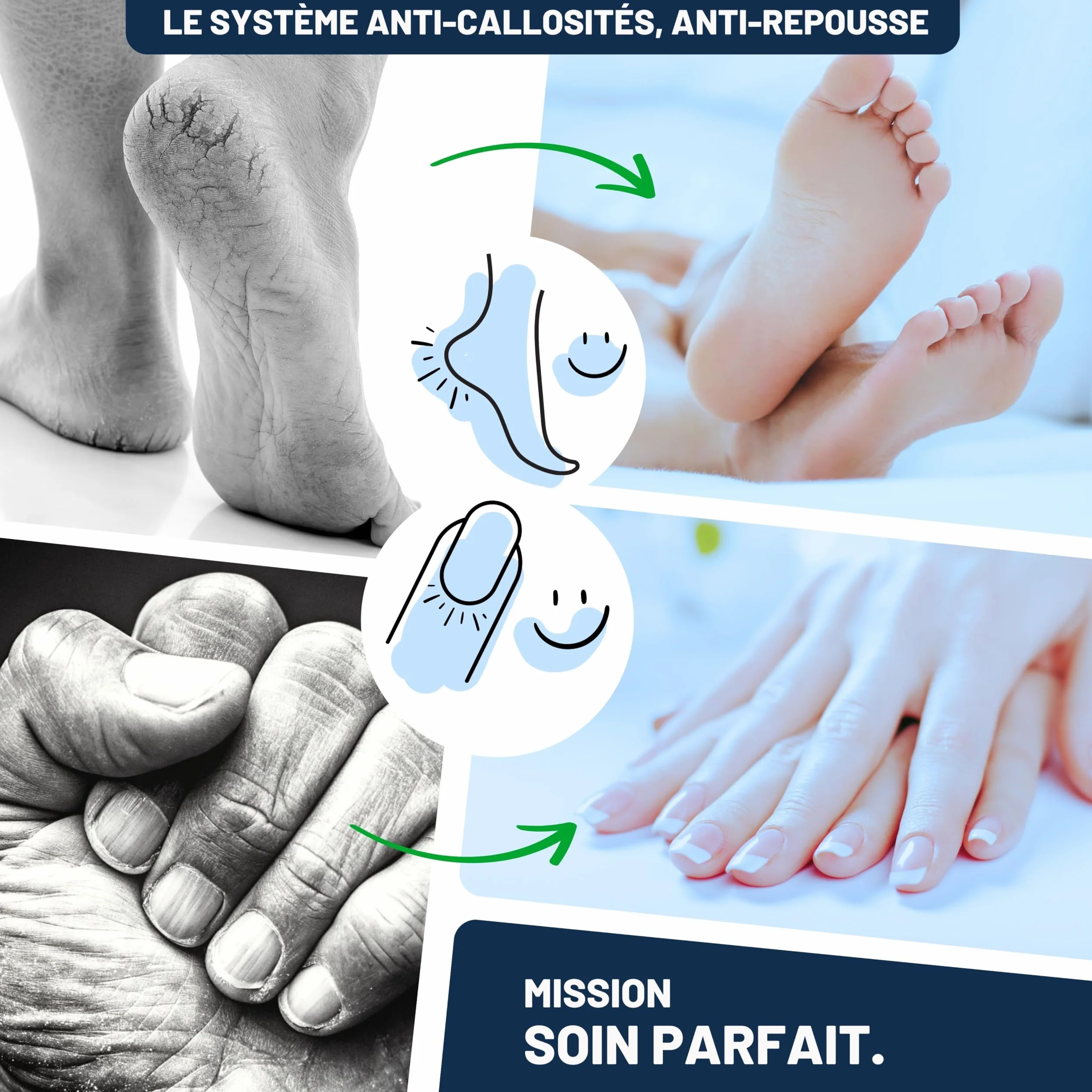 Mr. Fuss Solution No. 4 pour enlever la callosité 250ml Plus Pack Multi adoucissement rapide
